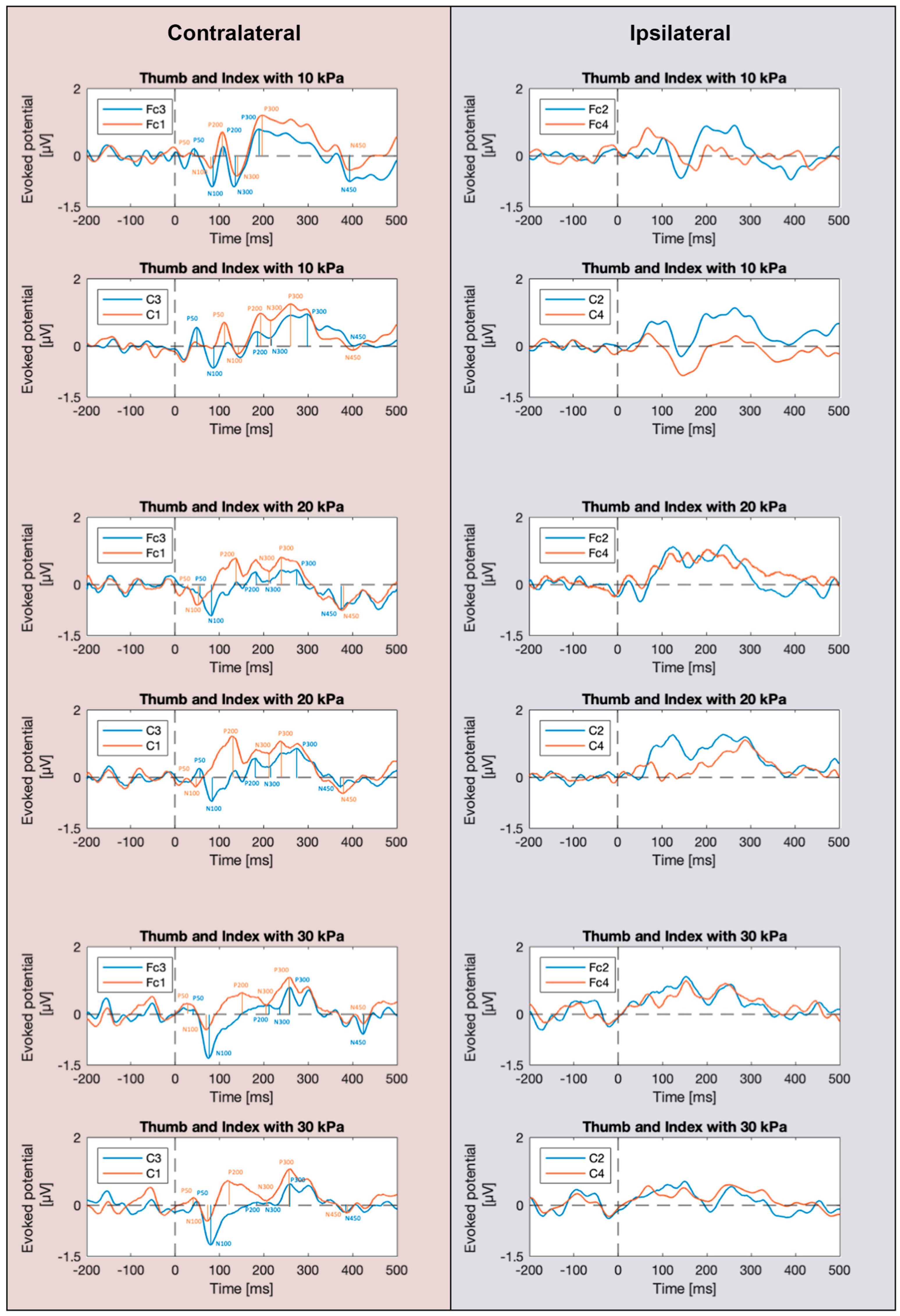 Actuators 12 00431 g004