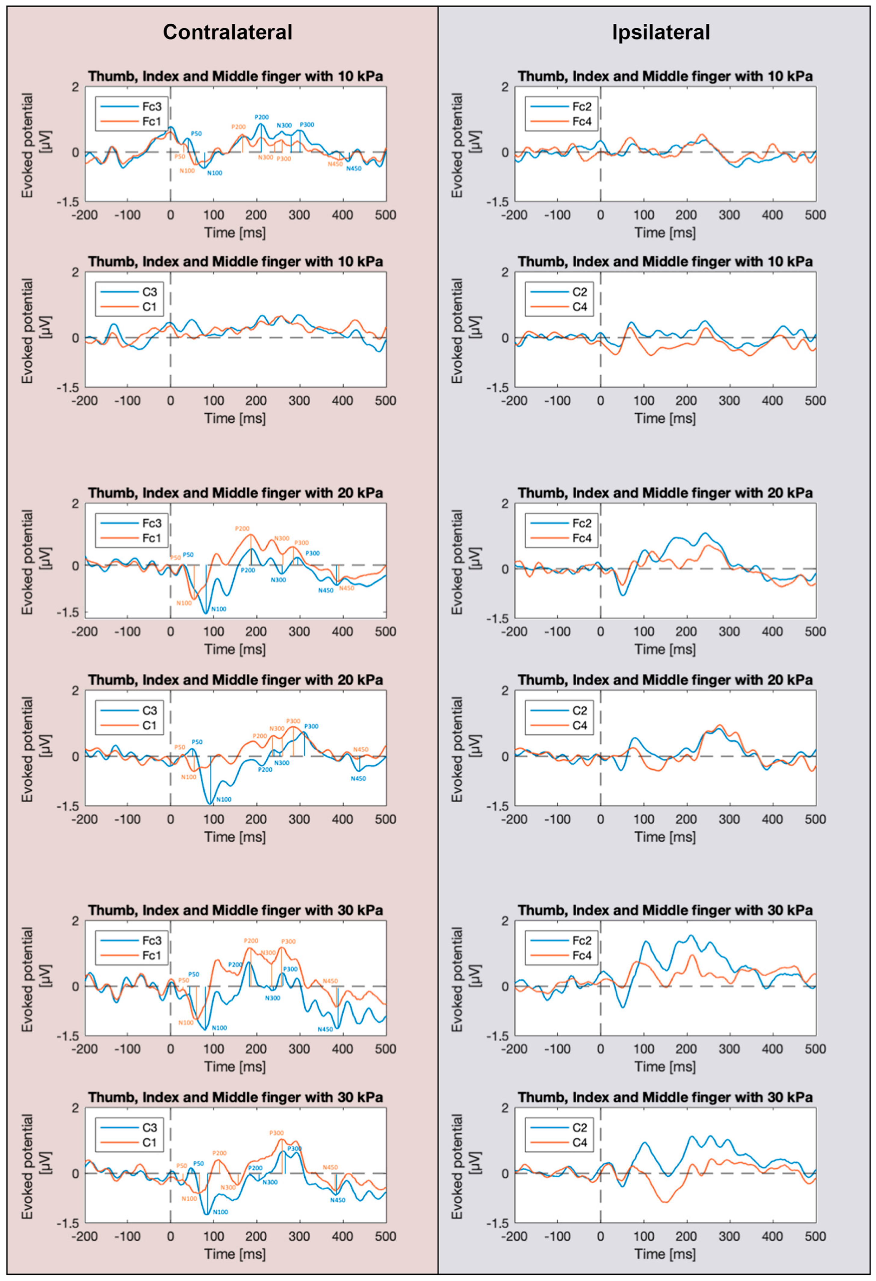 Actuators 12 00431 g005