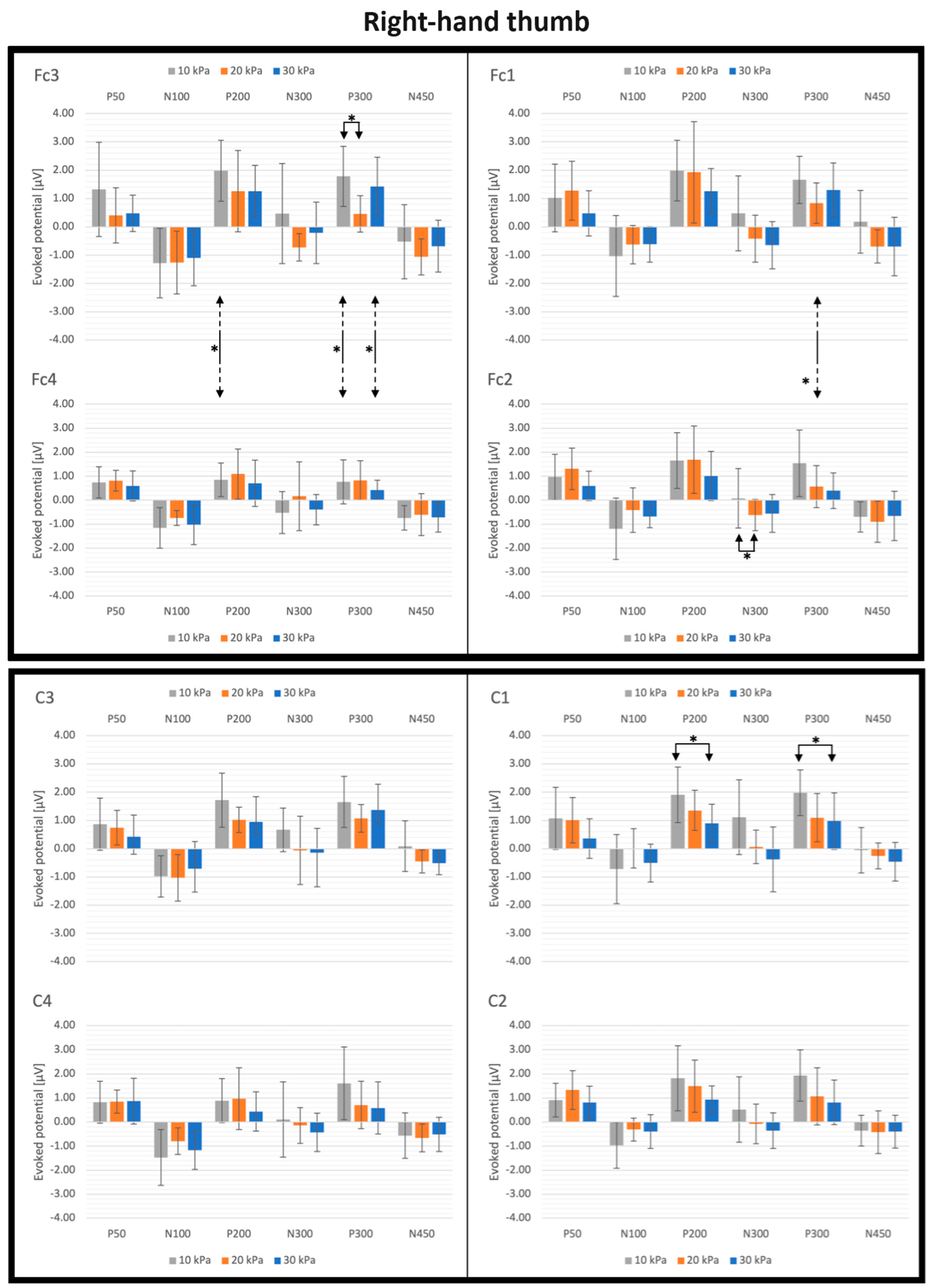 Actuators 12 00431 g007