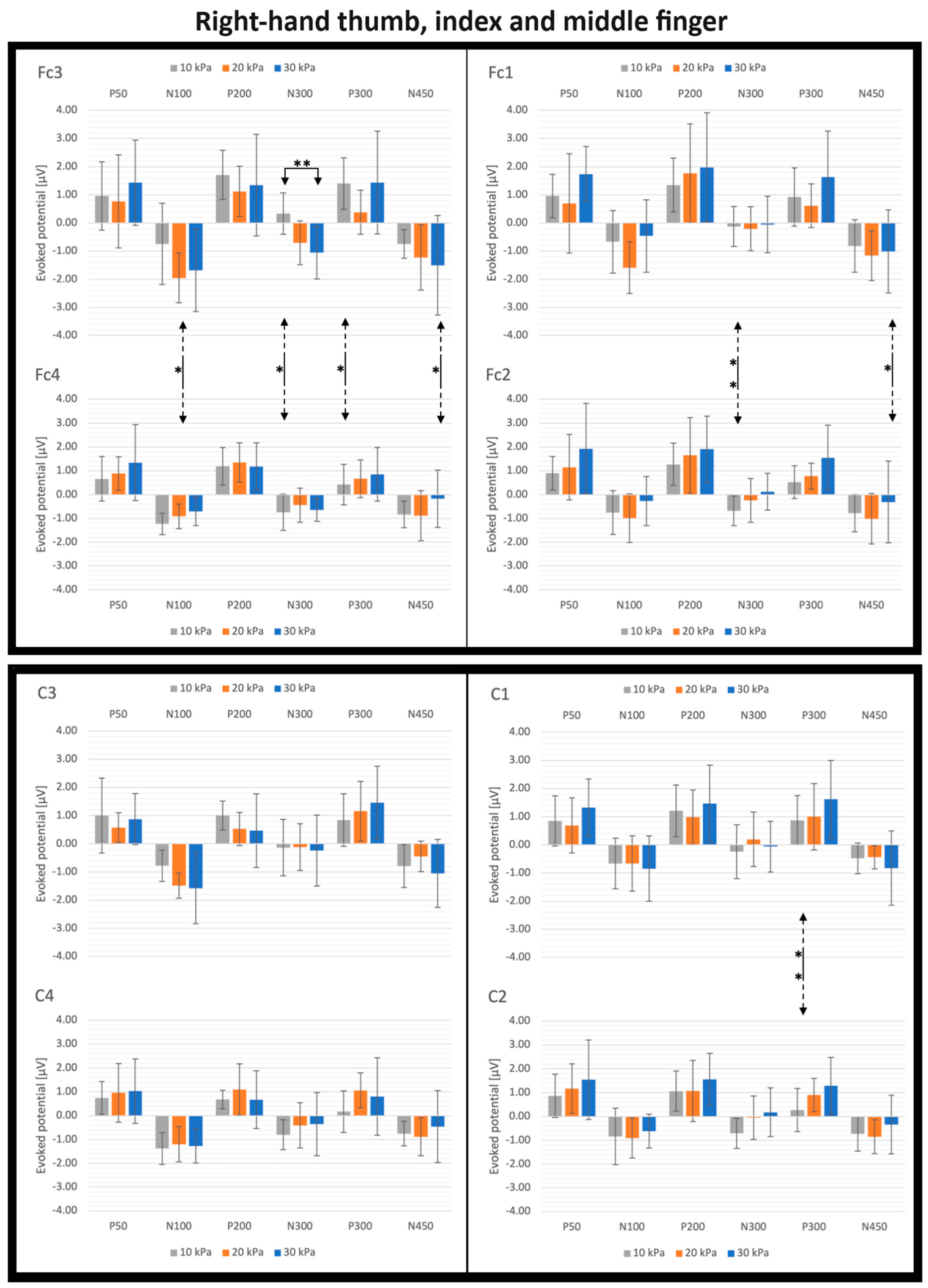 Actuators 12 00431 g011