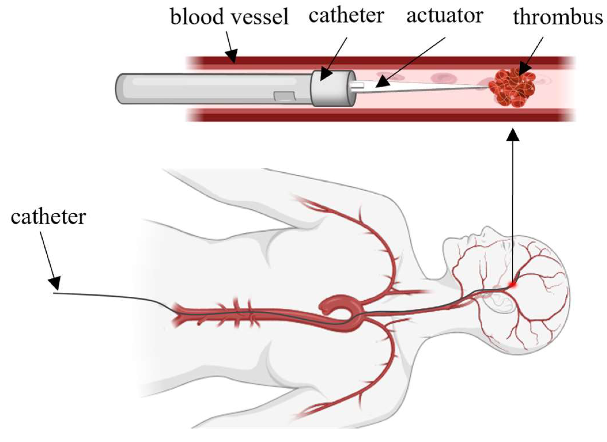 Actuators 14 00549 g001