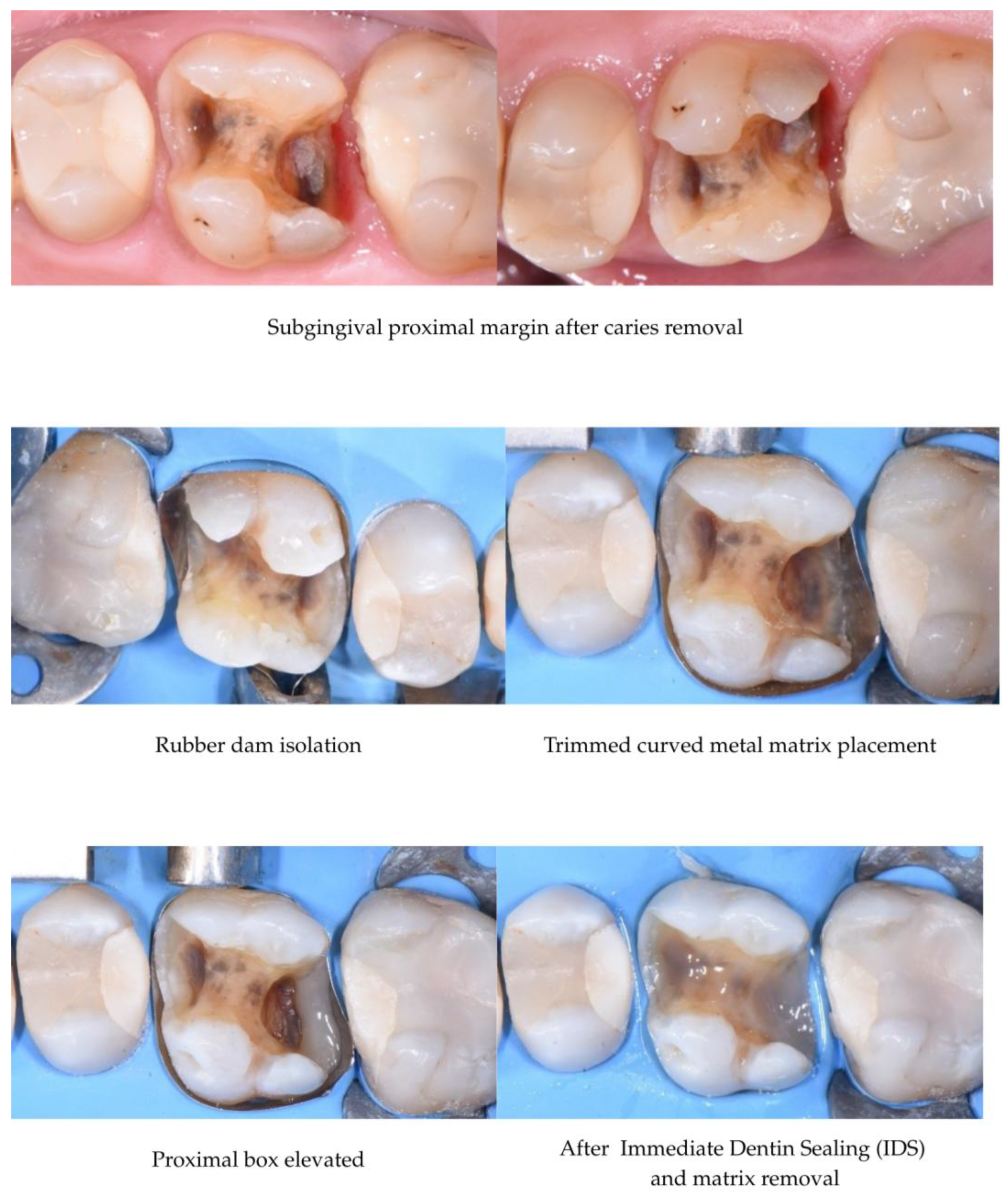 Adhesives 01 00010 g004