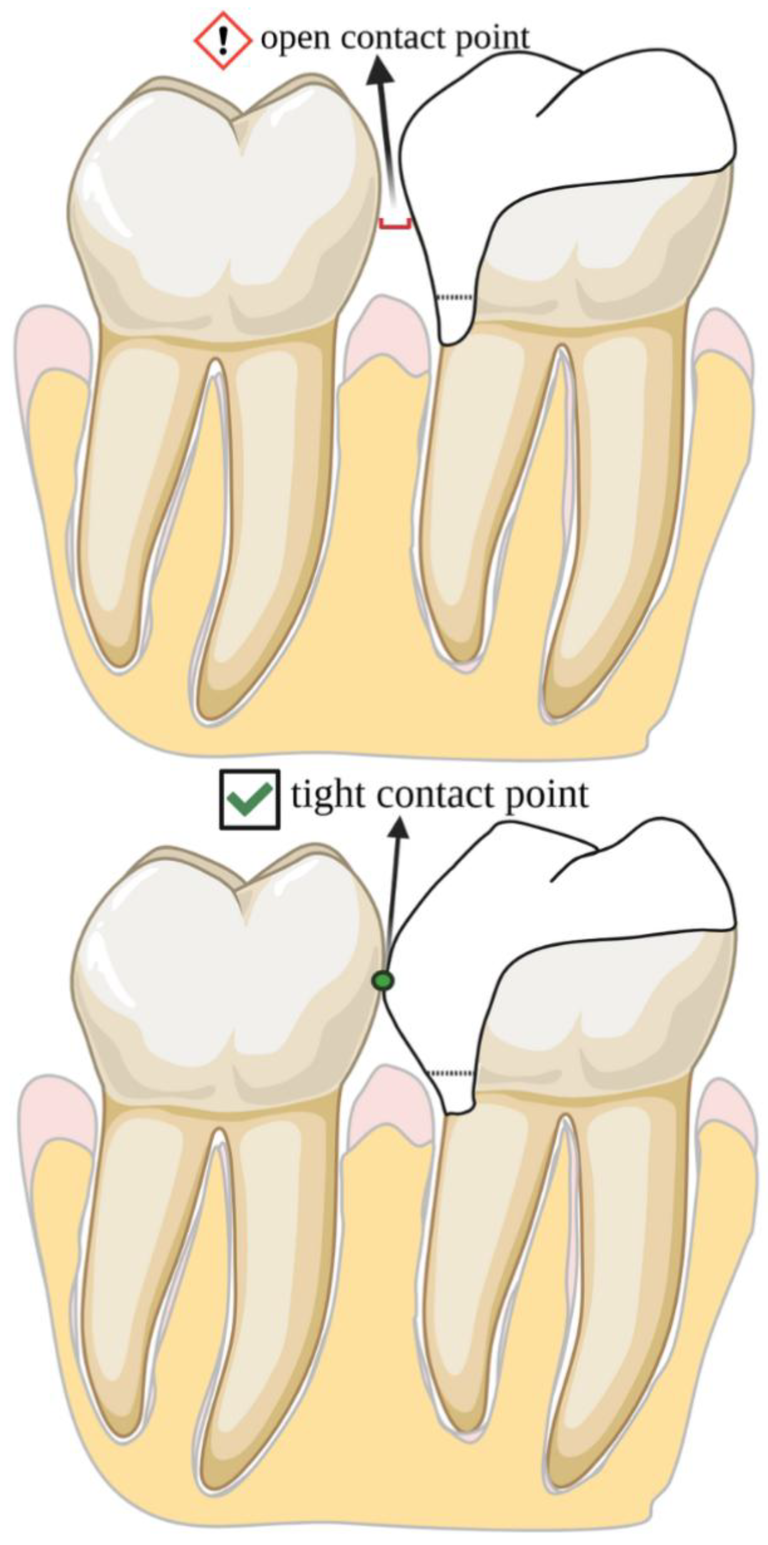 Adhesives 01 00010 g010