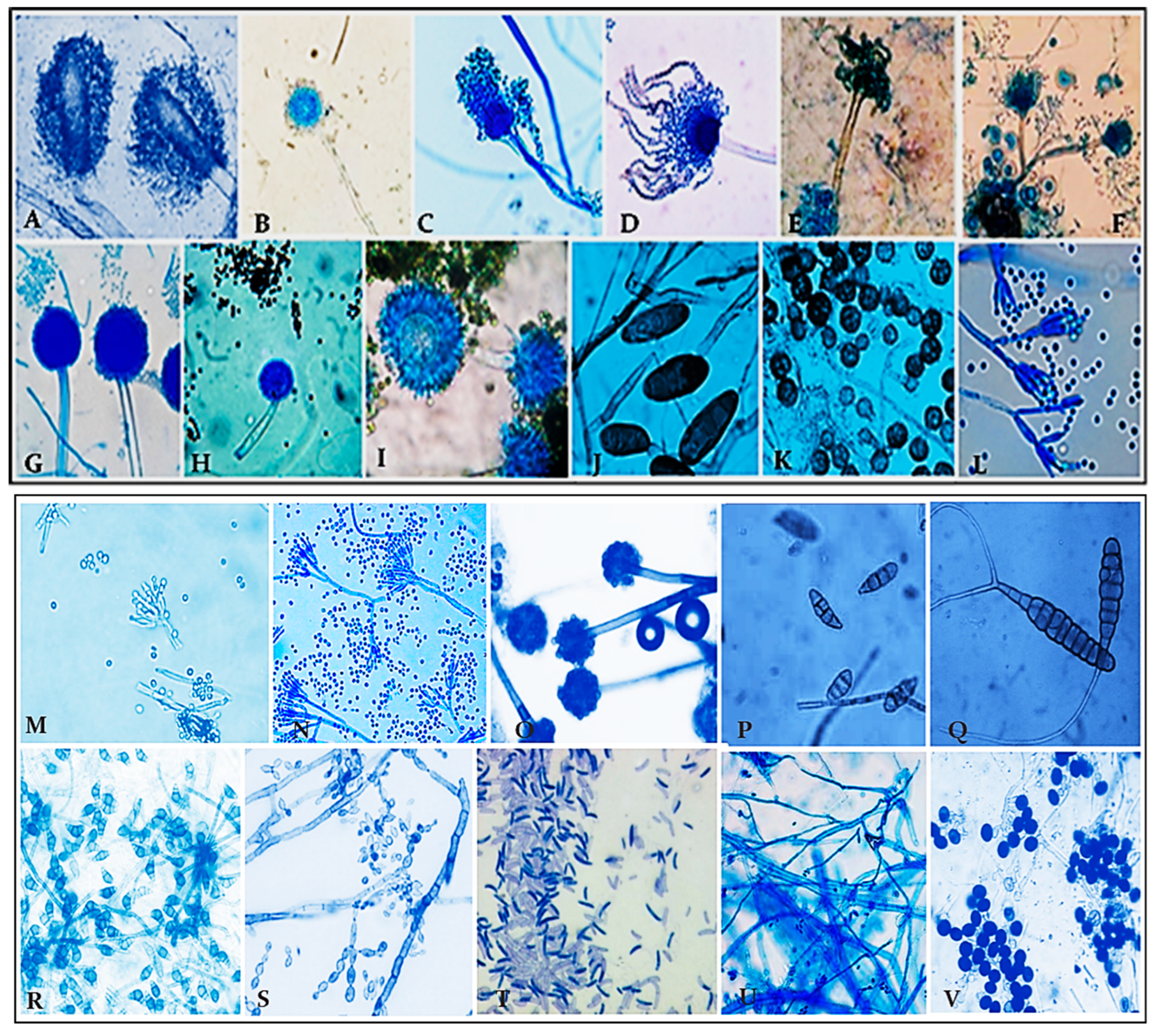 Aerobiology 04 00003 g004 Aerobiology 04 00003 g004