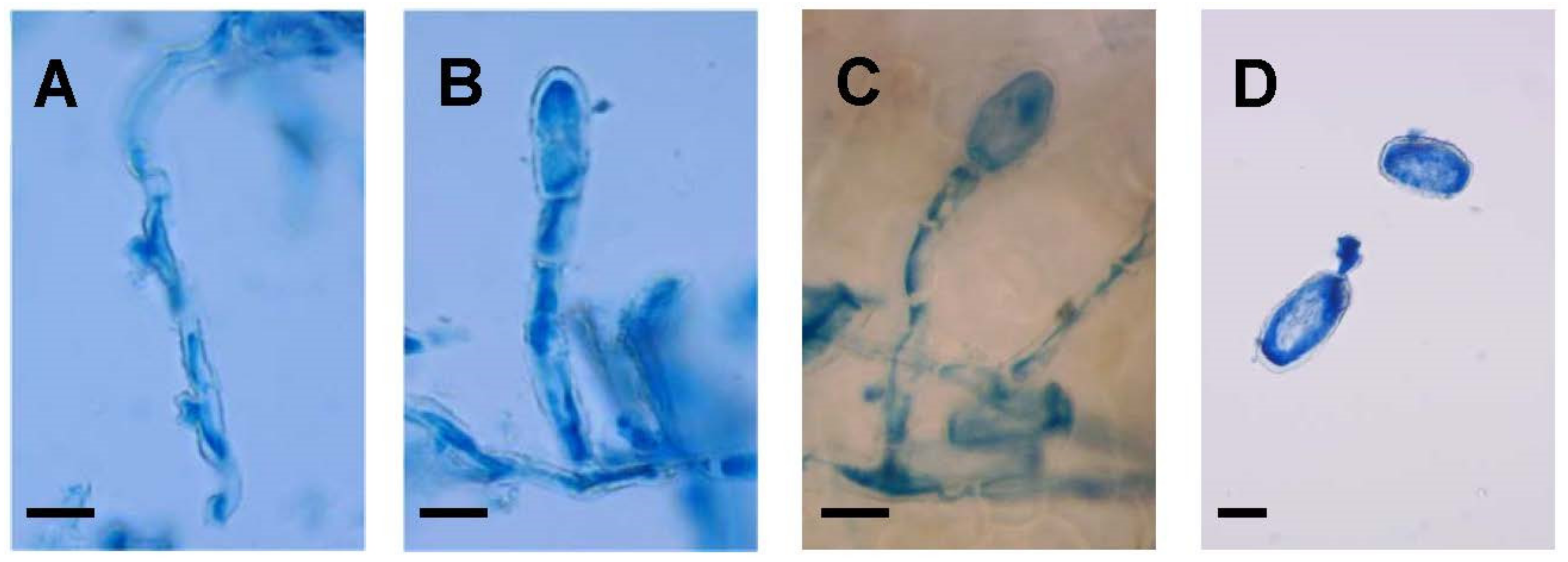 Agronomy Free FullText Sulla Powdery Mildew Phylogeny and Host Range