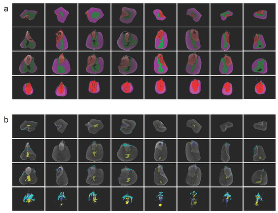 CT-Based Phenotyping and Genome-Wide Association Analysis of the ...