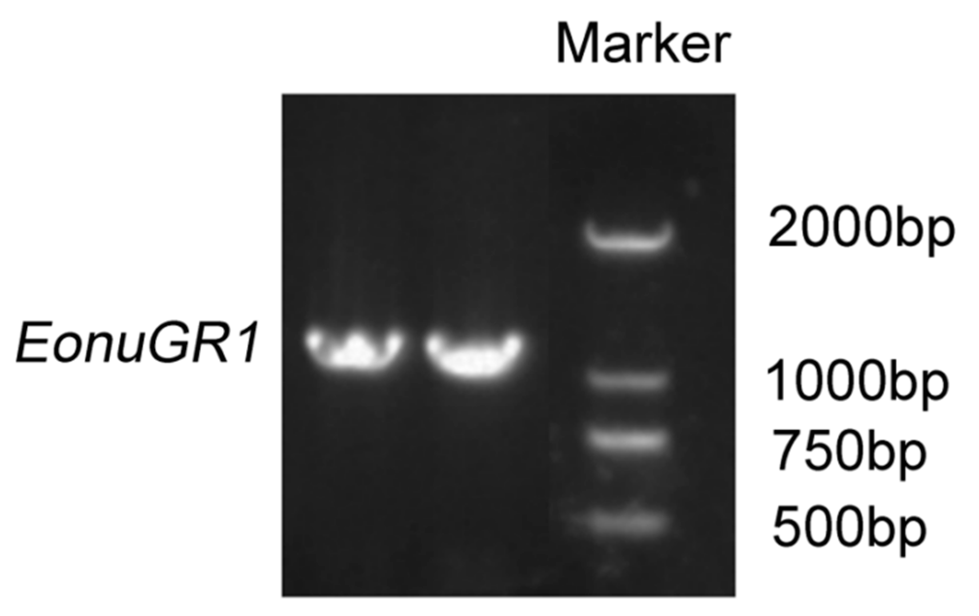 Blood Biomarkers as a Non-Invasive Method for the Assessment of the State  of the Fontan Circulation