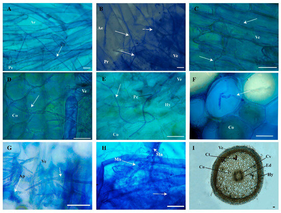 Evaluation of Tulasnella and Ceratobasidium as Biocontrol Agents of ...