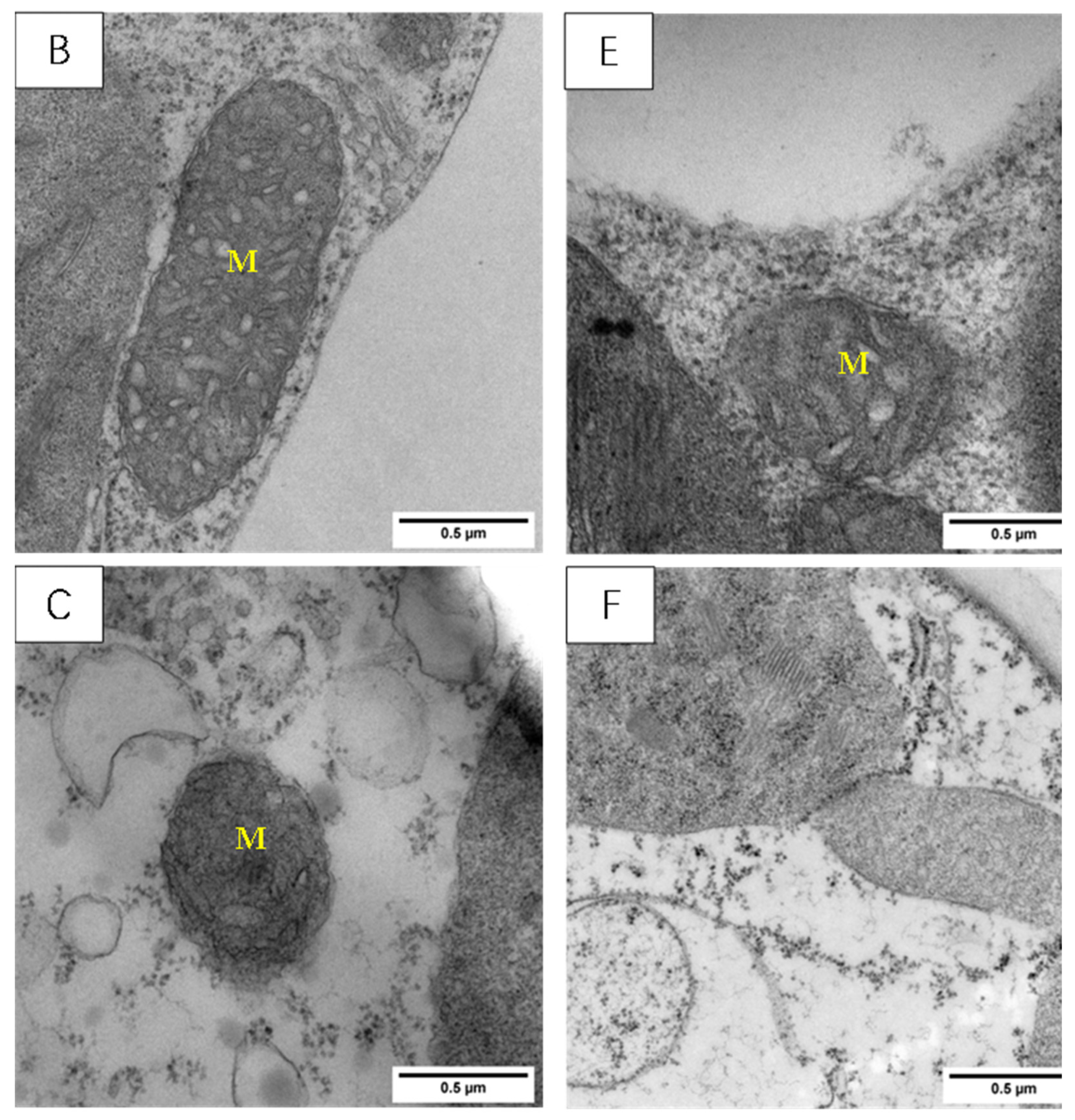 Agronomy 13 03011 g009b
