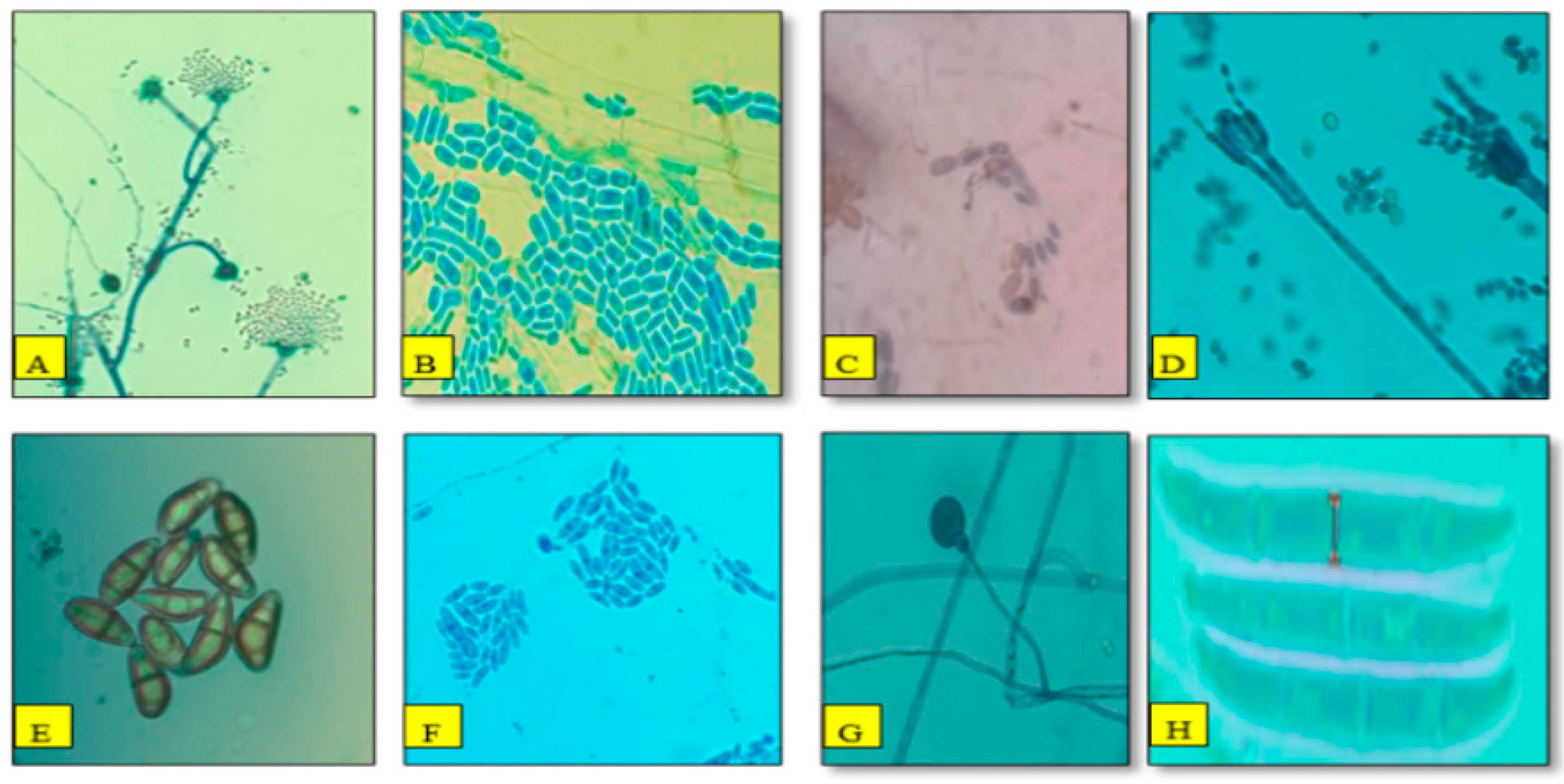 Agronomy 14 00661 g008