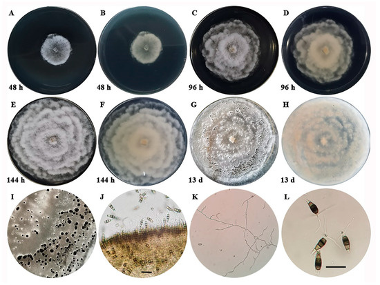 Occurrence of Neopestalotiopsis clavispora Causing Apple