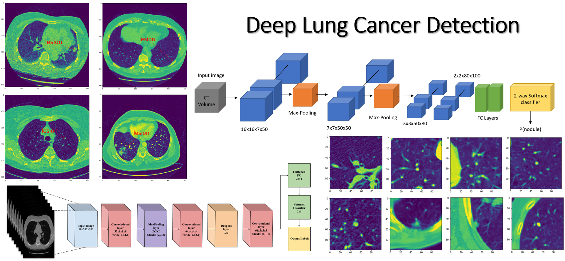 AI | Free Full-Text | Deep Learning for Lung Cancer Nodules Detection