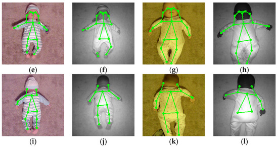 An Intelligent Baby Monitor with Automatic Sleeping Posture Detection ...