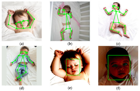 An Intelligent Baby Monitor with Automatic Sleeping Posture Detection ...