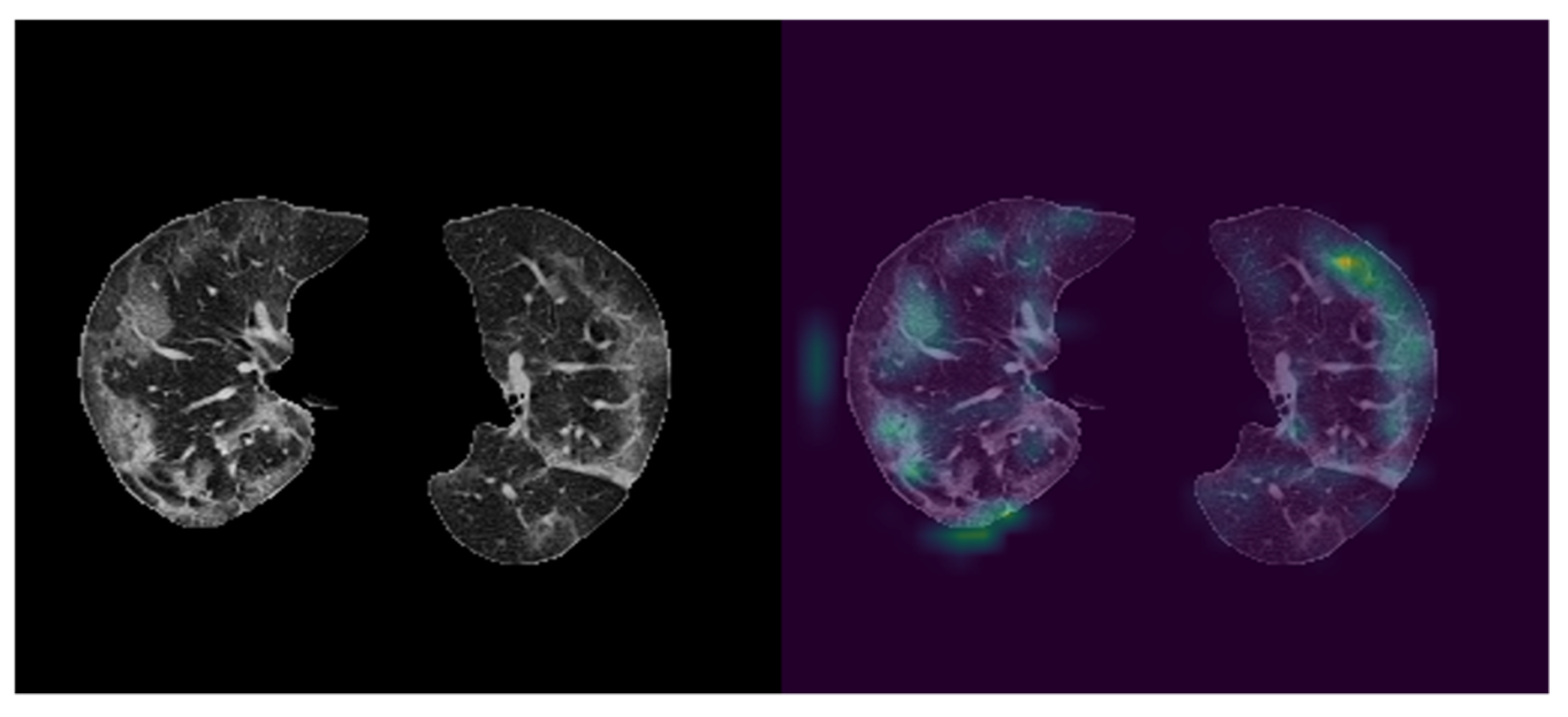 Ai 02 00020 g005 550