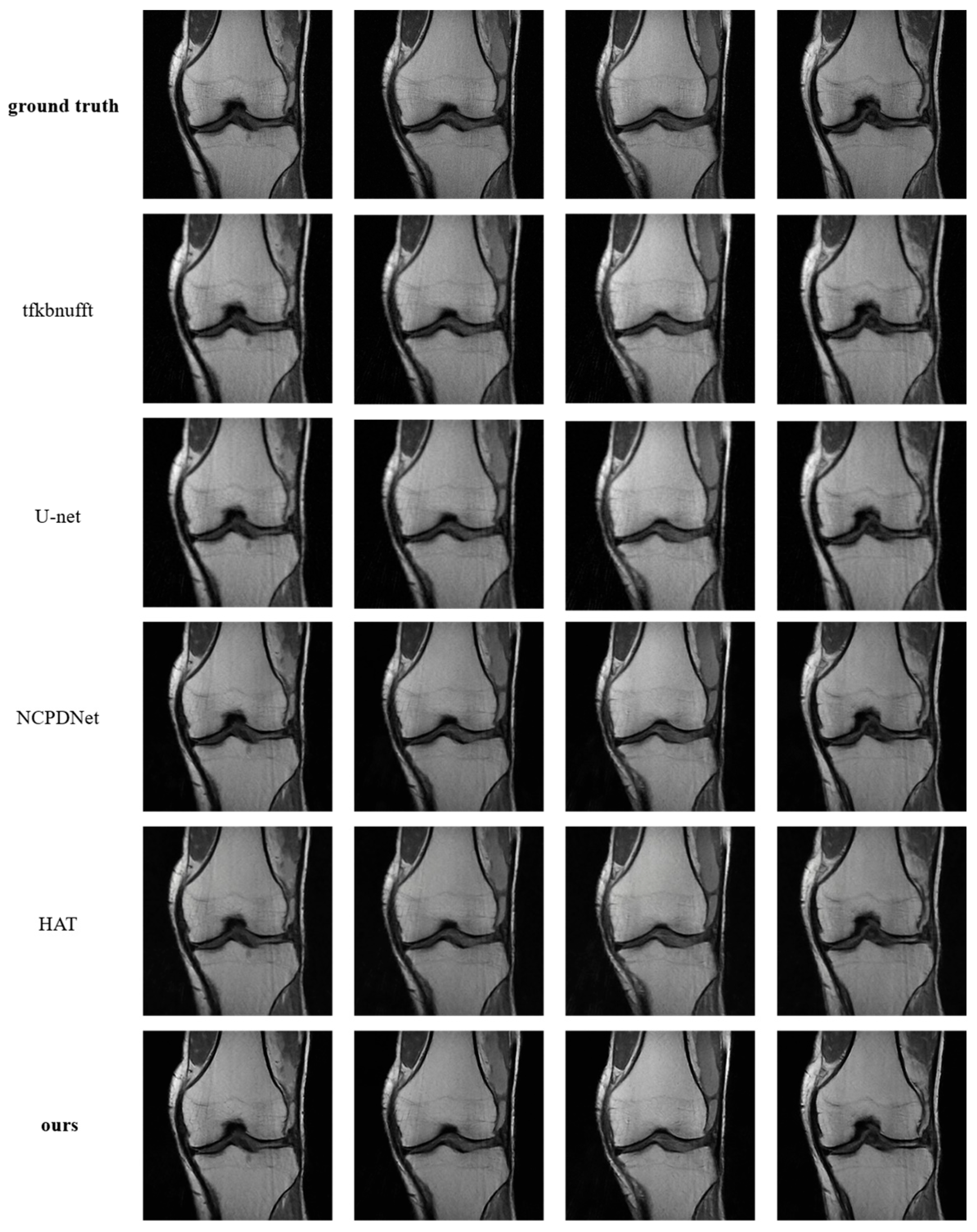 Ai 06 00291 g014 Ai 06 00291 g014