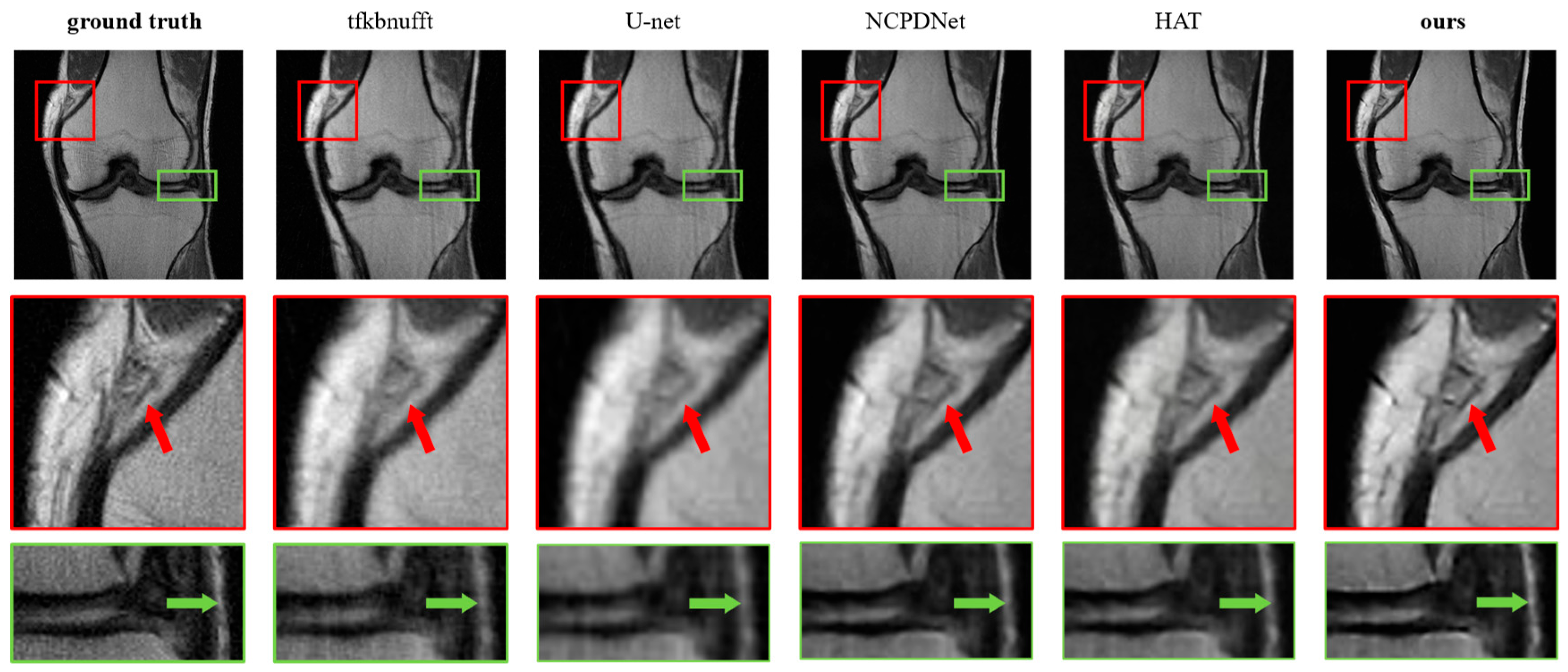 Ai 06 00291 g016 Ai 06 00291 g016
