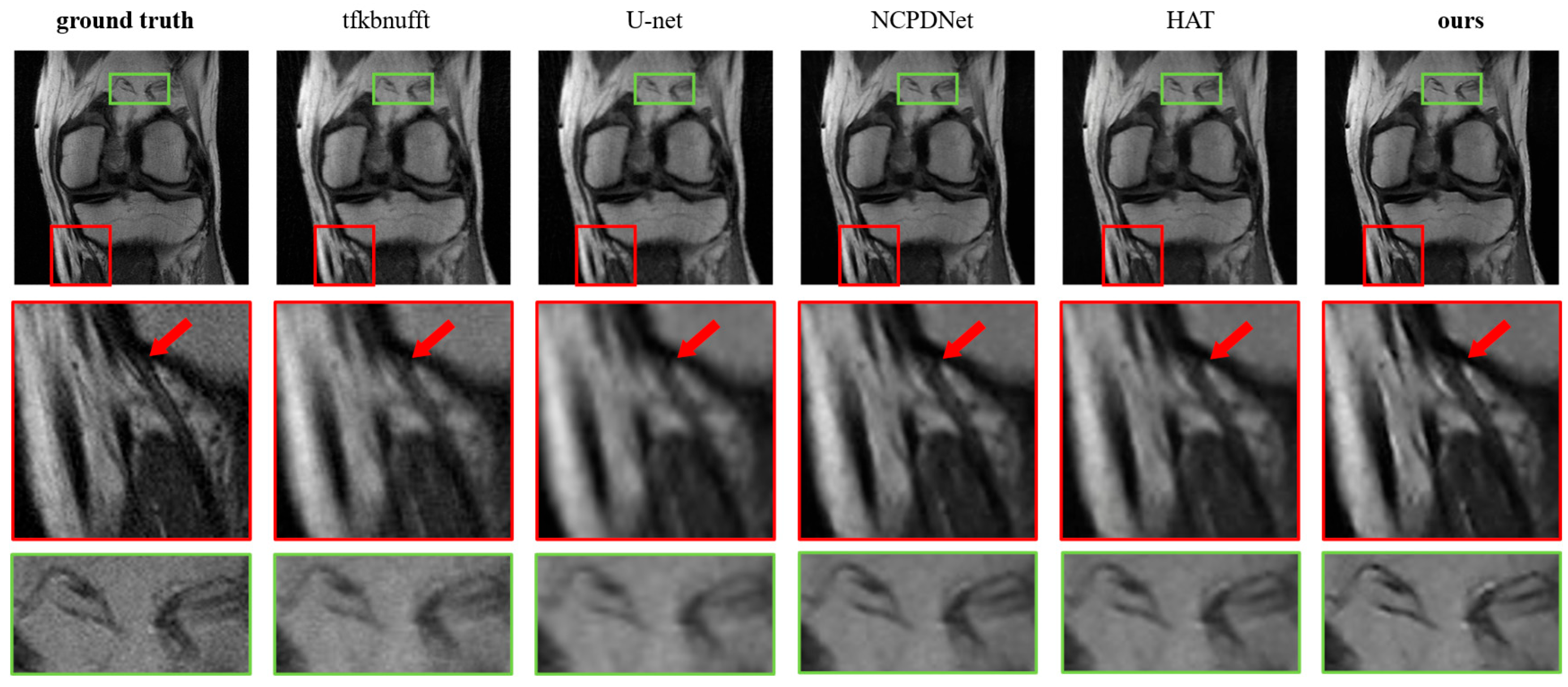 Ai 06 00291 g017 Ai 06 00291 g017