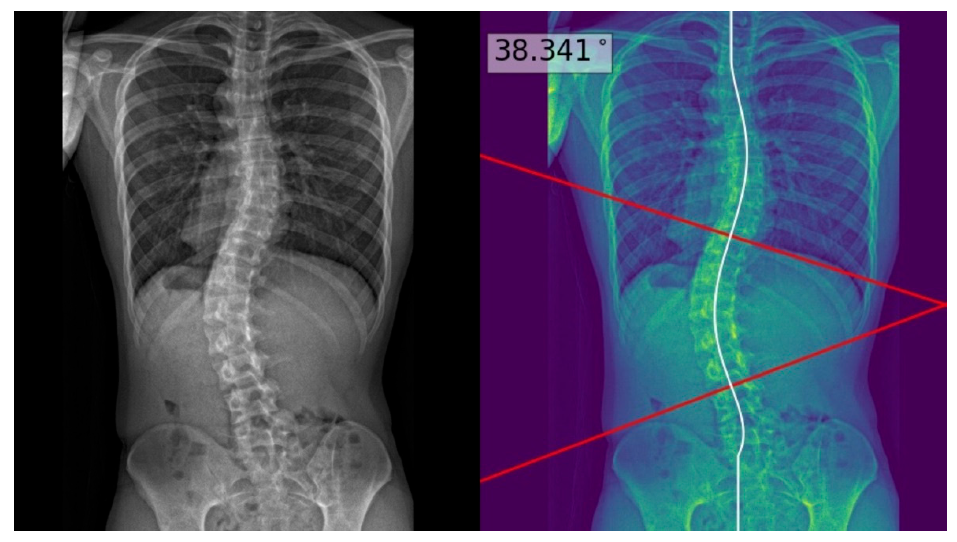 Ai 06 00318 g002 Ai 06 00318 g002