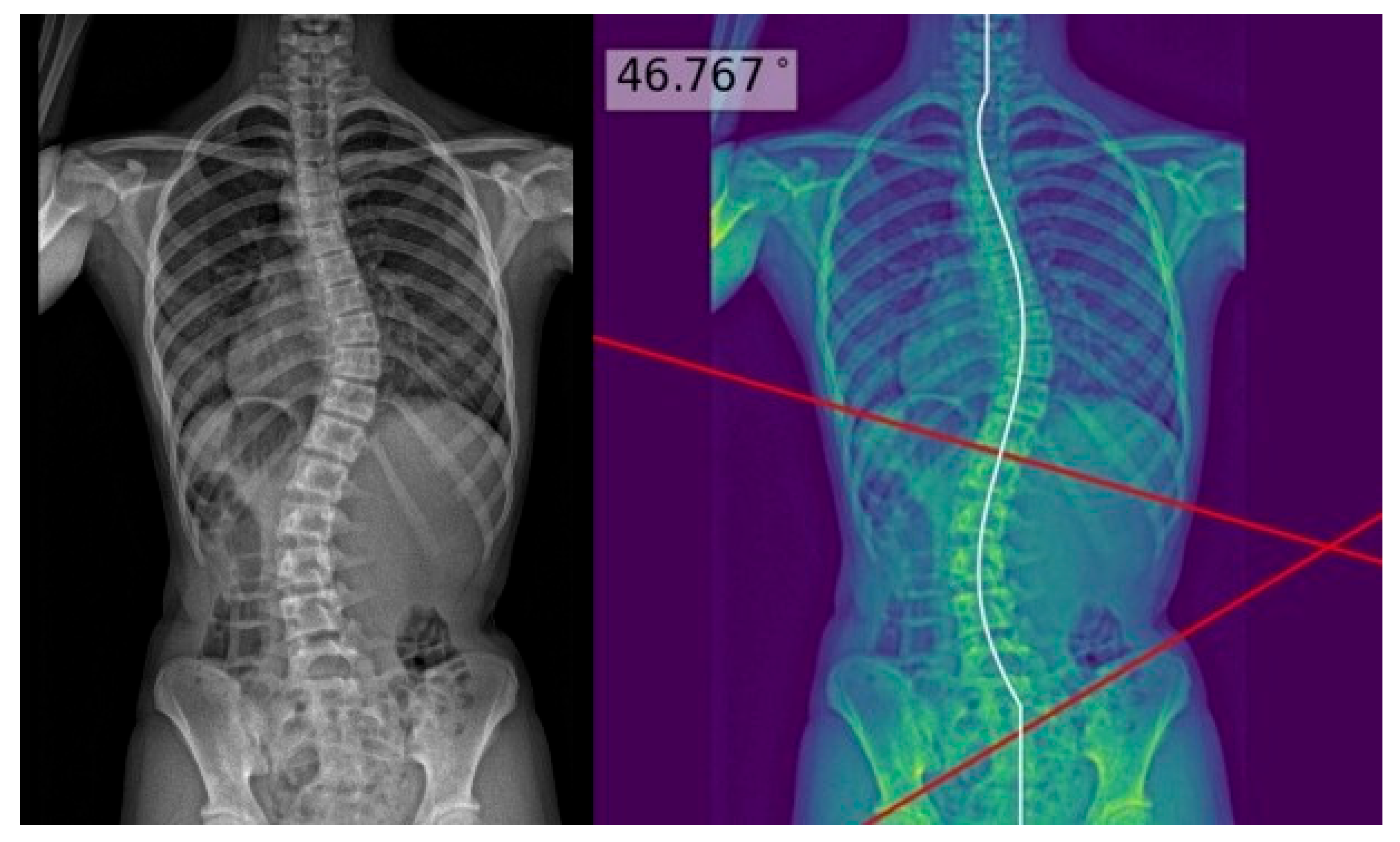 Ai 06 00318 g003 Ai 06 00318 g003