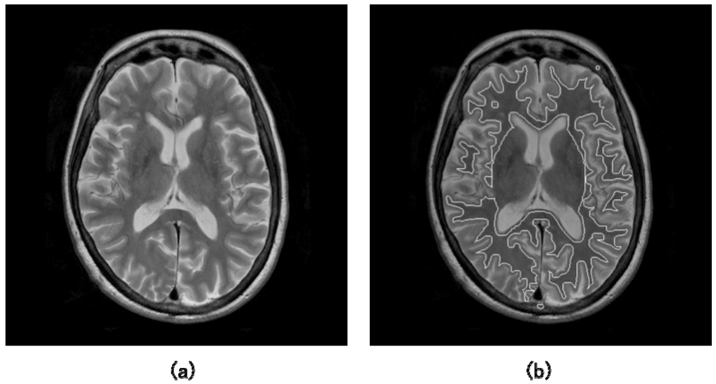 Computer-Aided Diagnosis Systems for Brain Diseases in Magnetic