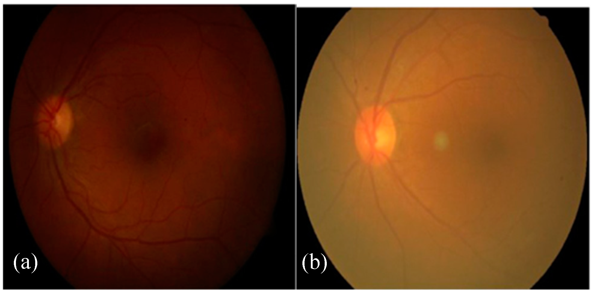 Algorithms 12 00014 g002