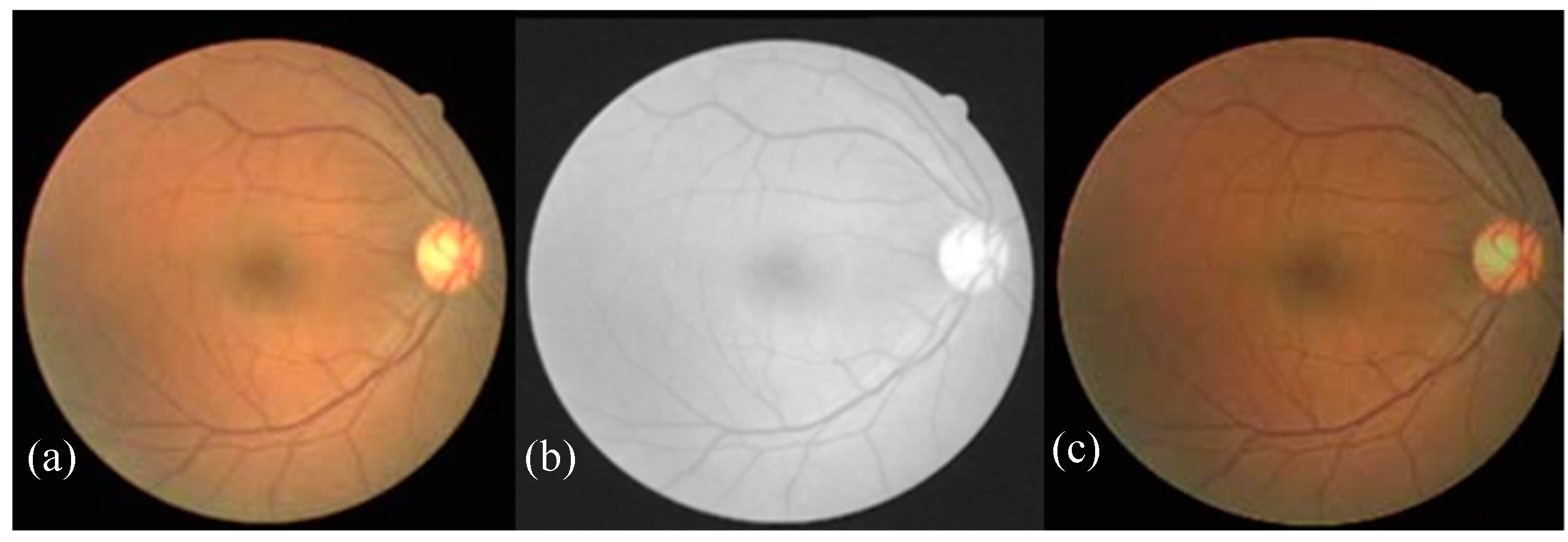 Algorithms 12 00014 g006