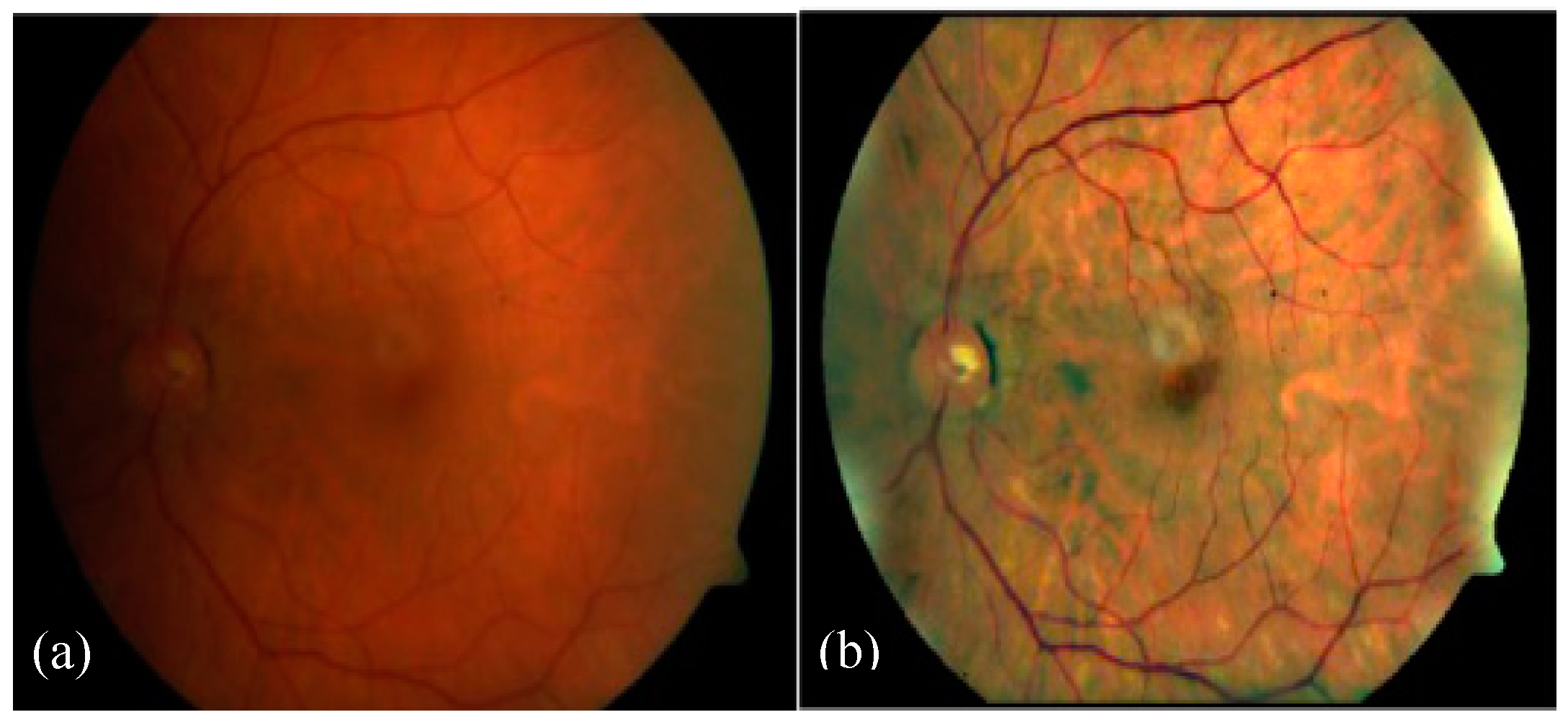 Algorithms 12 00014 g010