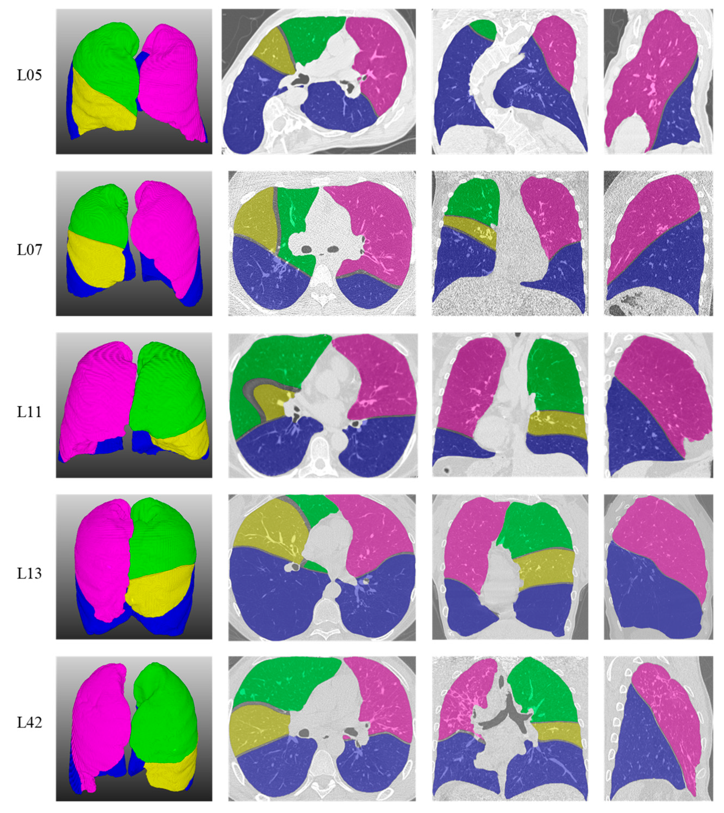 Algorithms 13 00263 g006