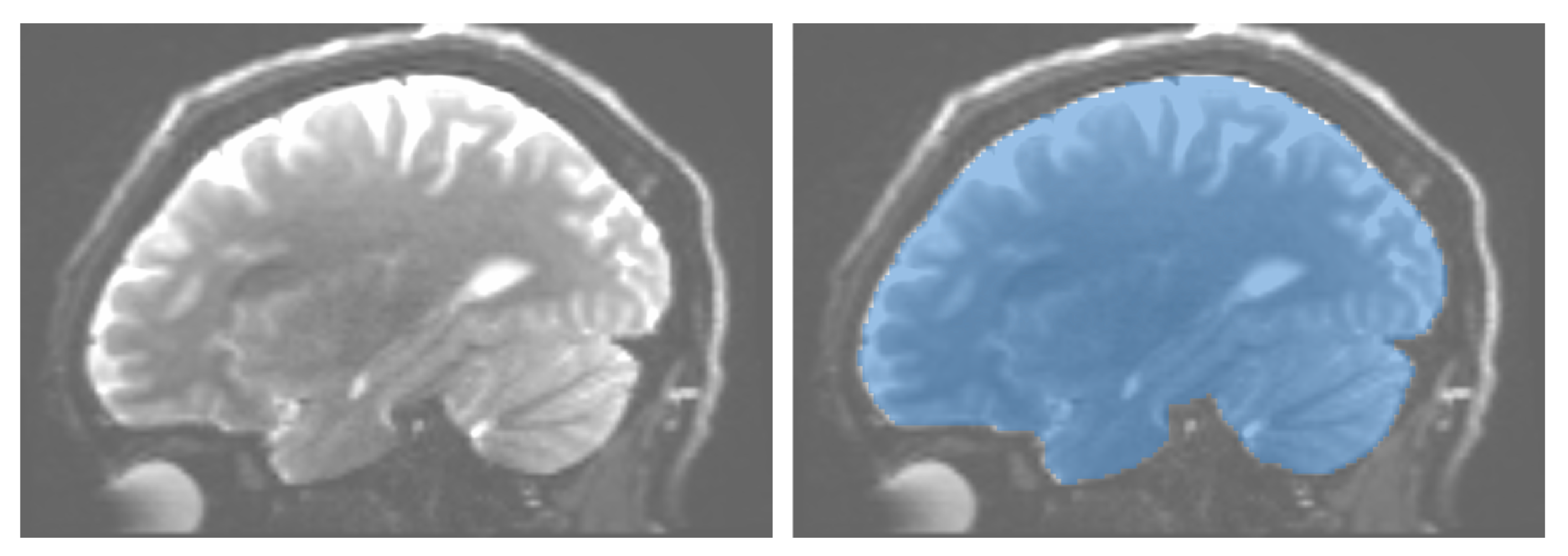 Algorithms 13 00316 g001