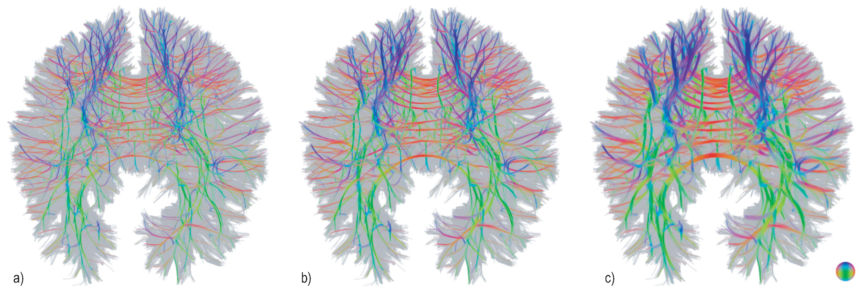 Algorithms 13 00316 g003