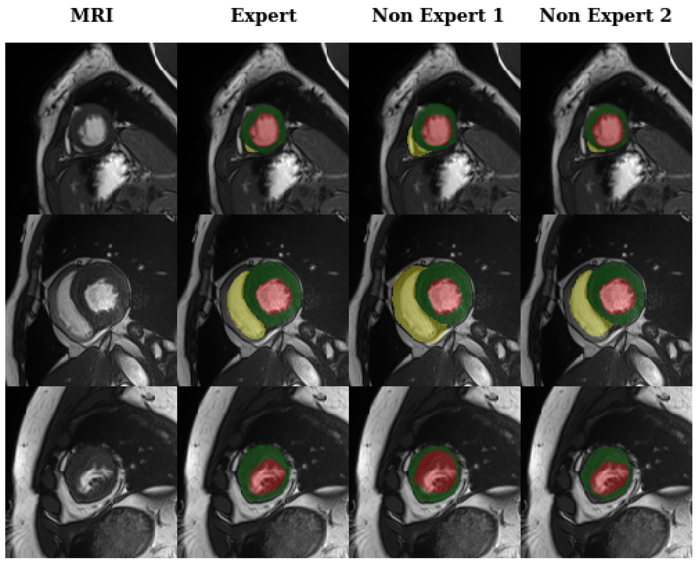 Algorithms 14 00212 g001