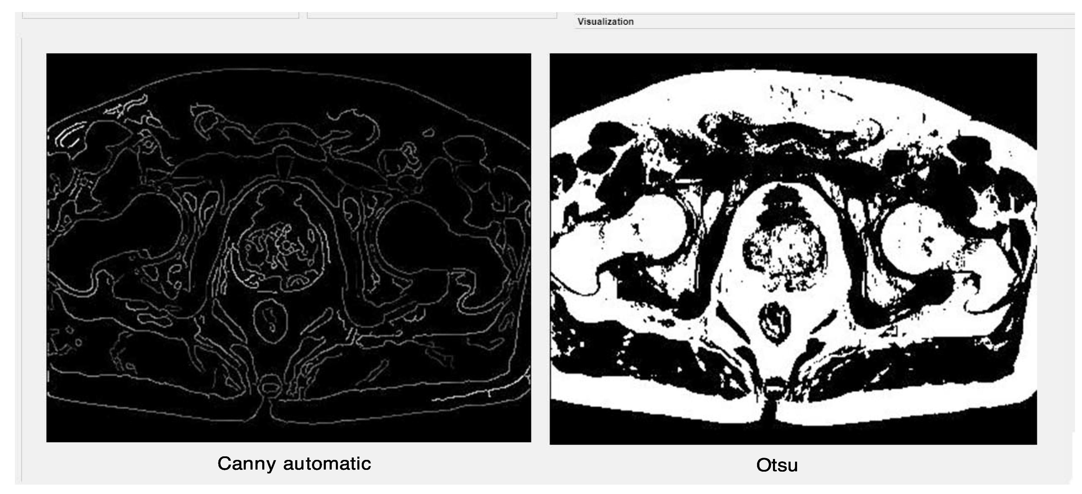 Algorithms 15 00200 g008 550