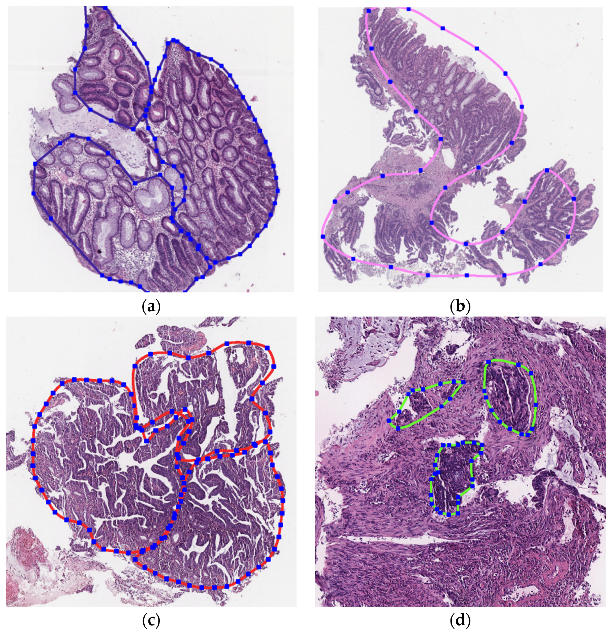 Algorithms 15 00398 g001
