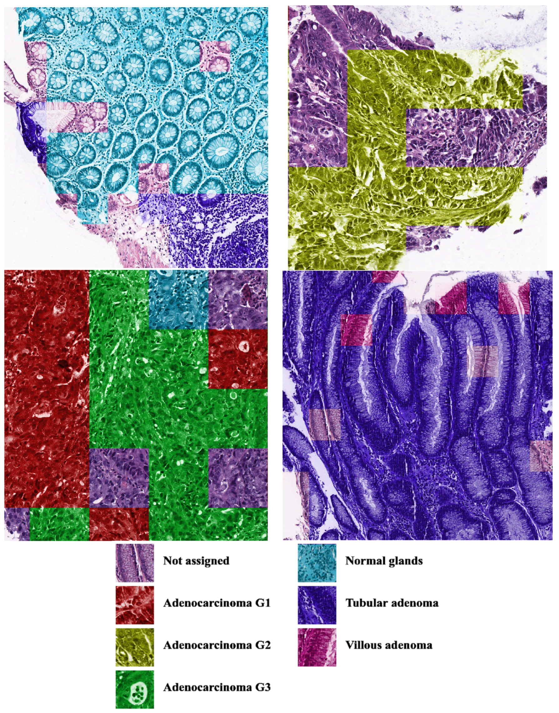 Algorithms 15 00398 g008