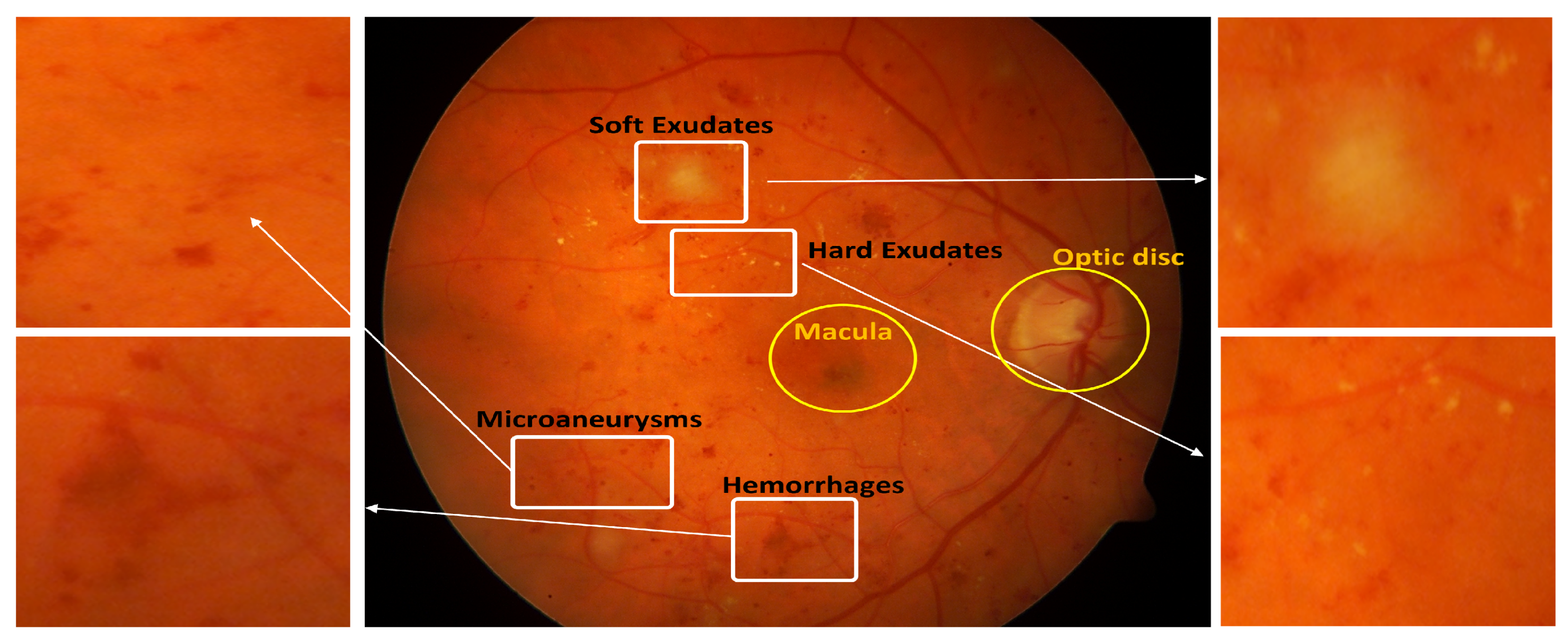 Algorithms 16 00147 g001