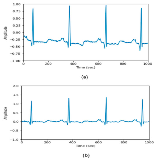 Algorithms | Free Full-Text | Unsupervised Transformer-Based Anomaly ...