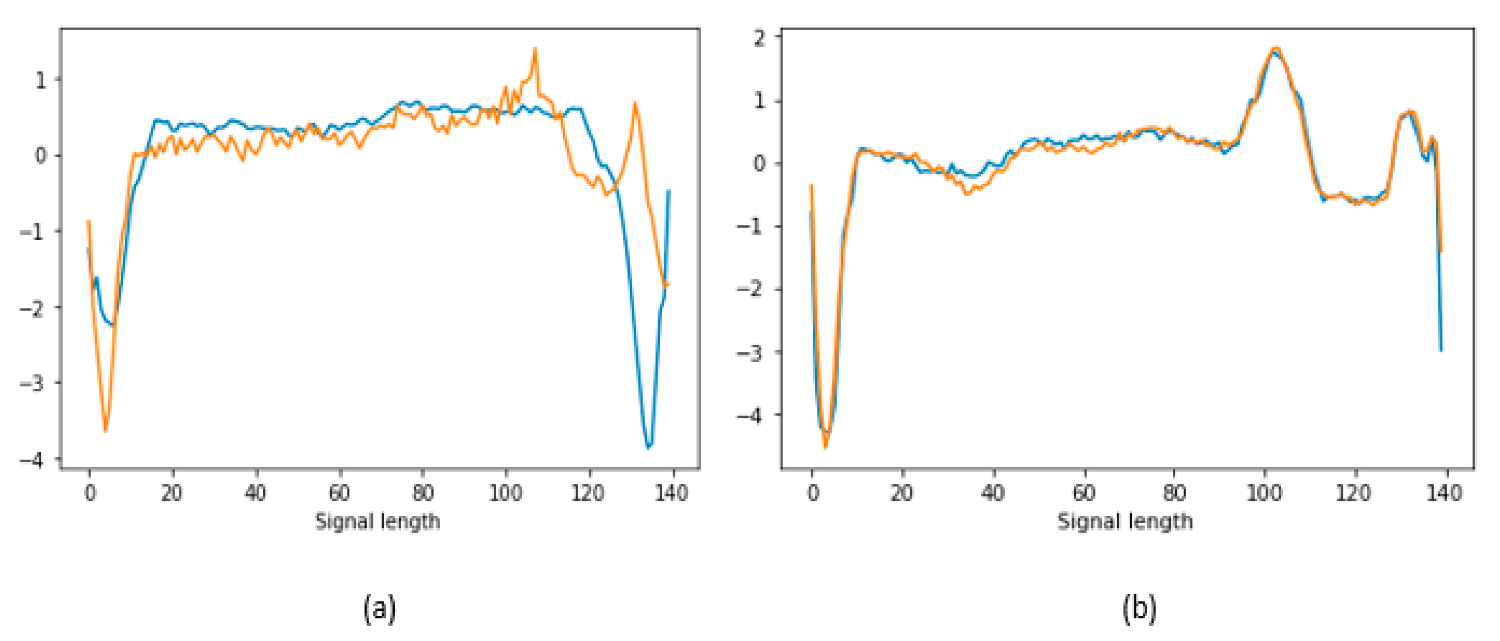 Unsupervised Transformer-Based Anomaly Detection in ECG Signals