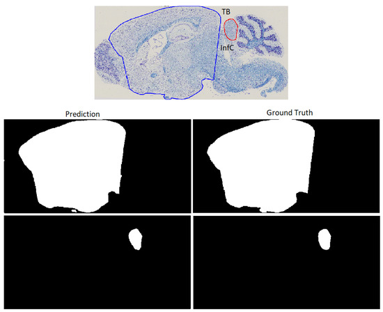 Large-scale neuroanatomical study uncovers 198 gene associations in mouse  brain morphogenesis