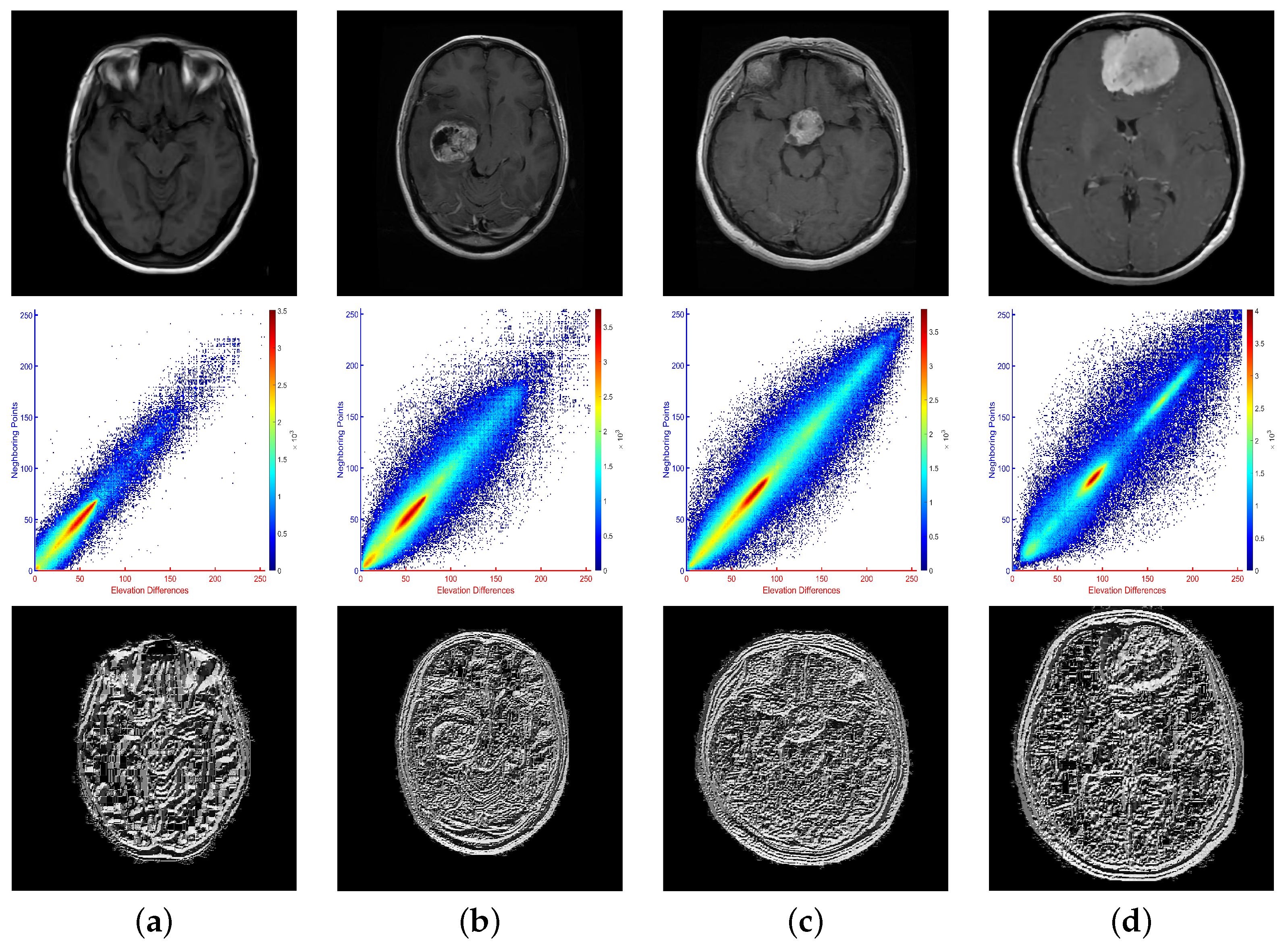 A Hybrid Learning-Architecture for Improved Brain Tumor Recognition