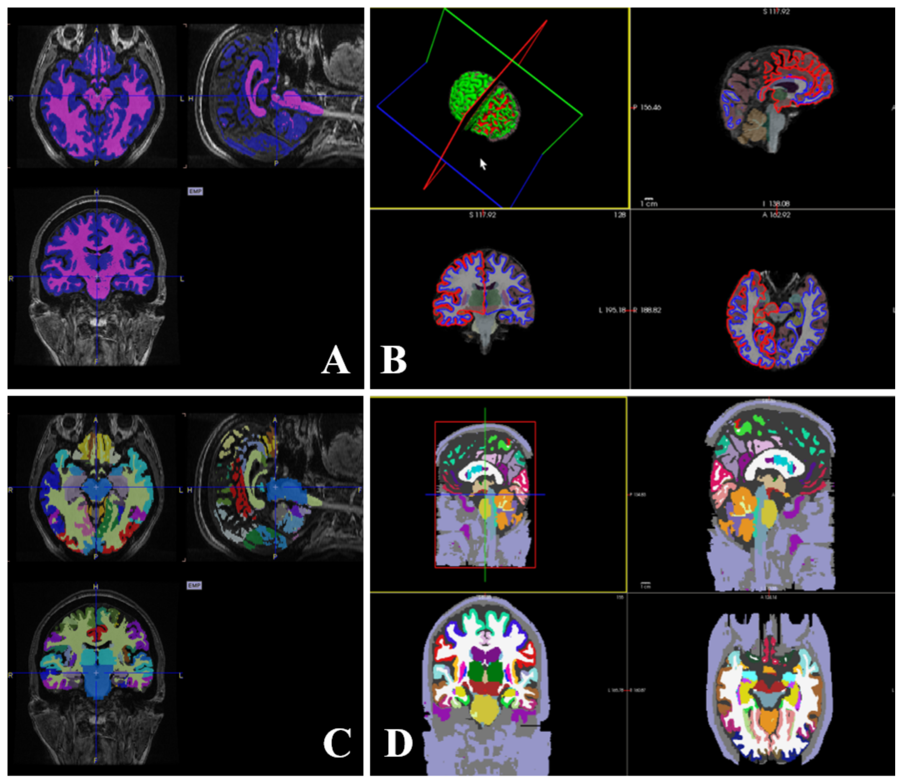 Algorithms 18 00057 g002 Algorithms 18 00057 g002