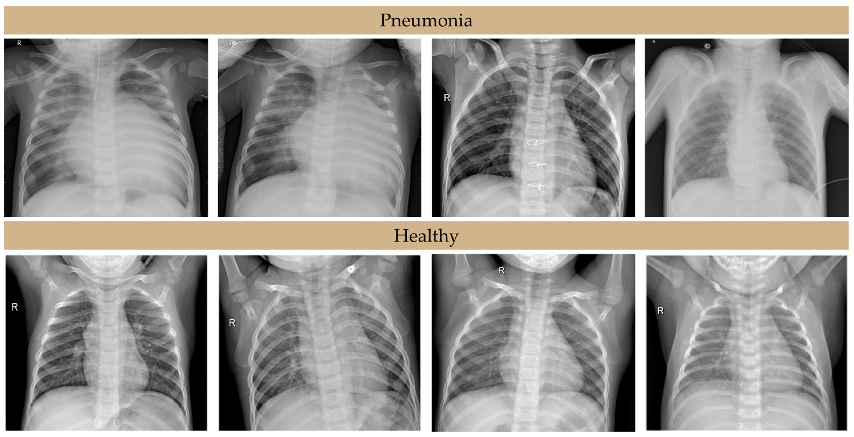 Algorithms 18 00098 g002