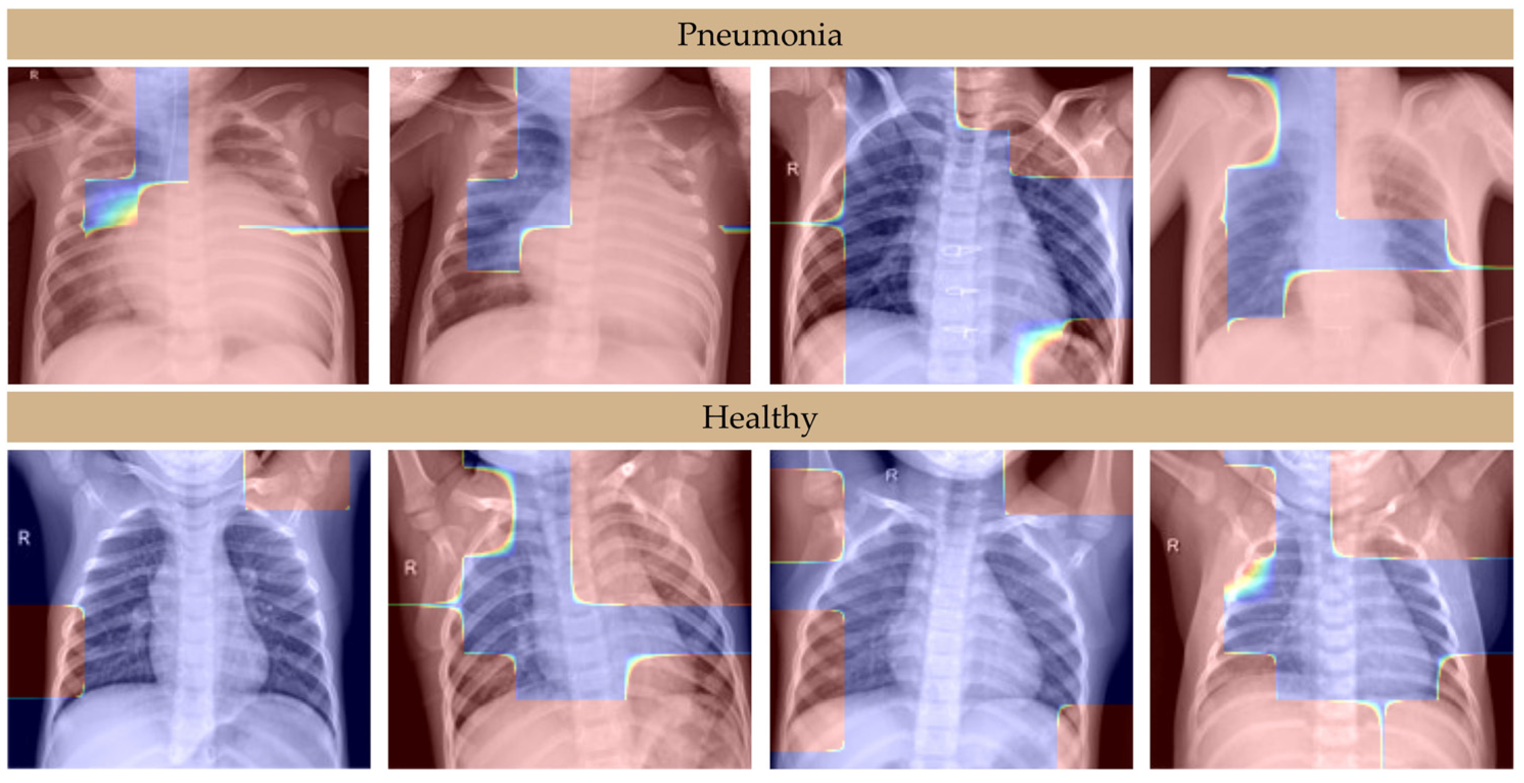 Algorithms 18 00098 g004