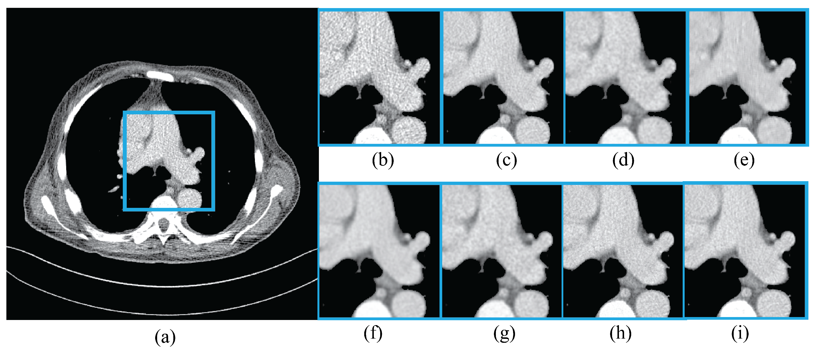 Algorithms 18 00134 g012