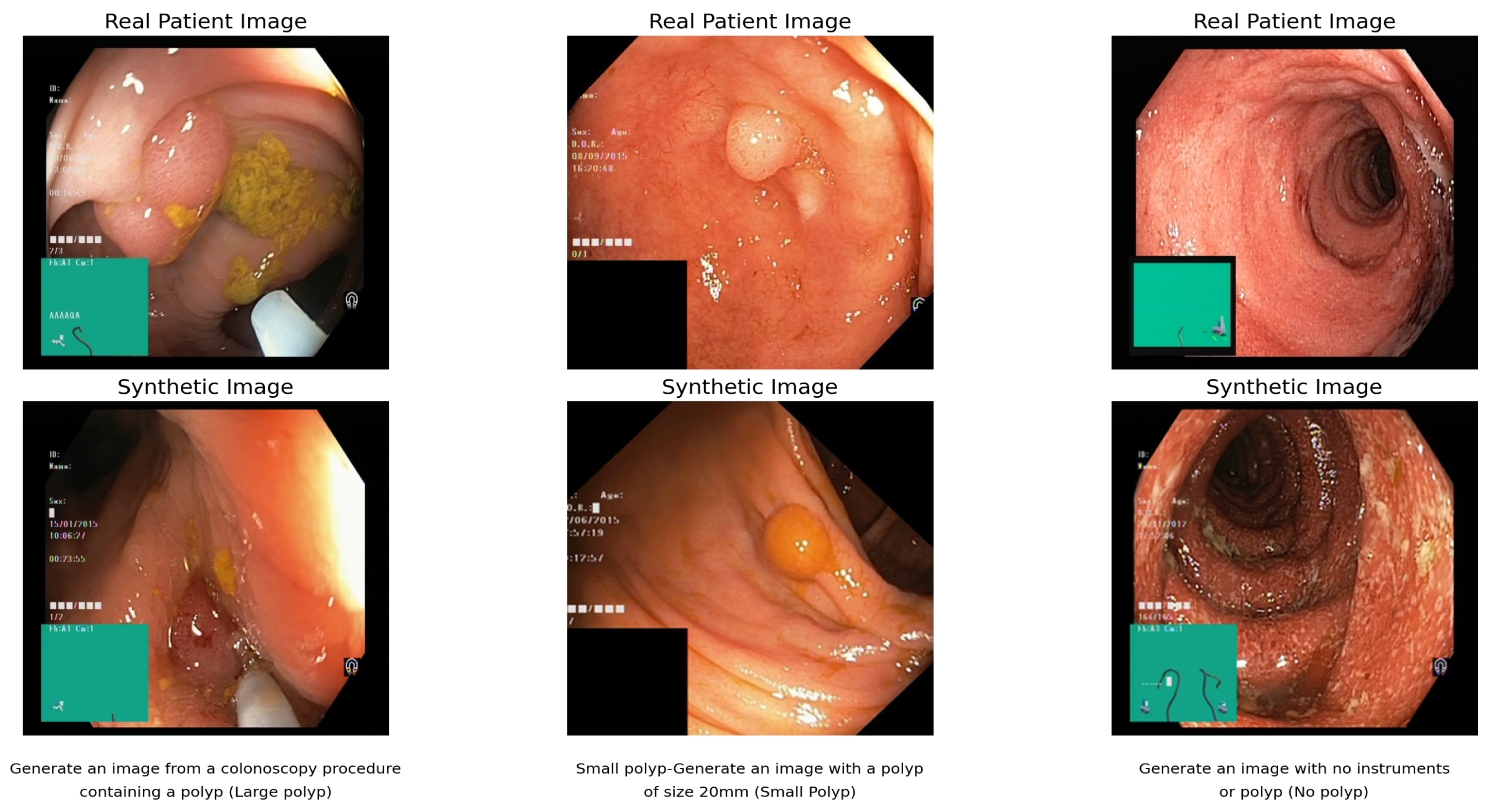 Algorithms 18 00155 g004