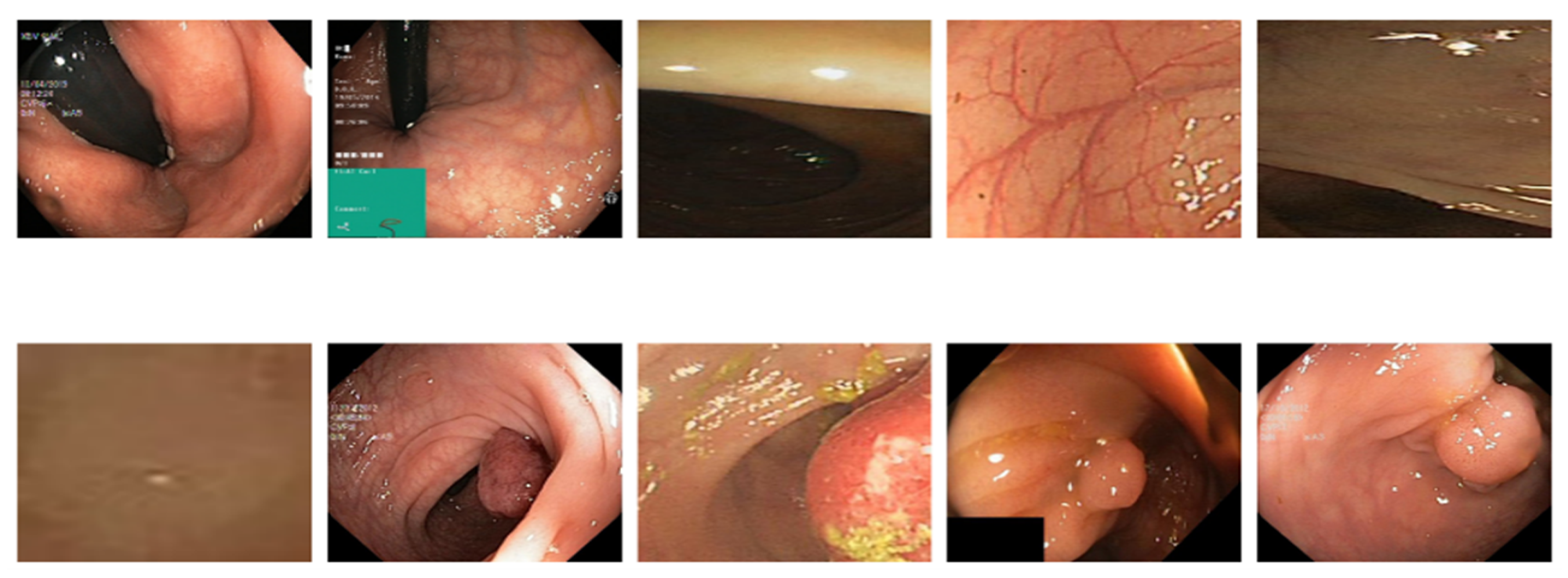 Algorithms 18 00155 g012