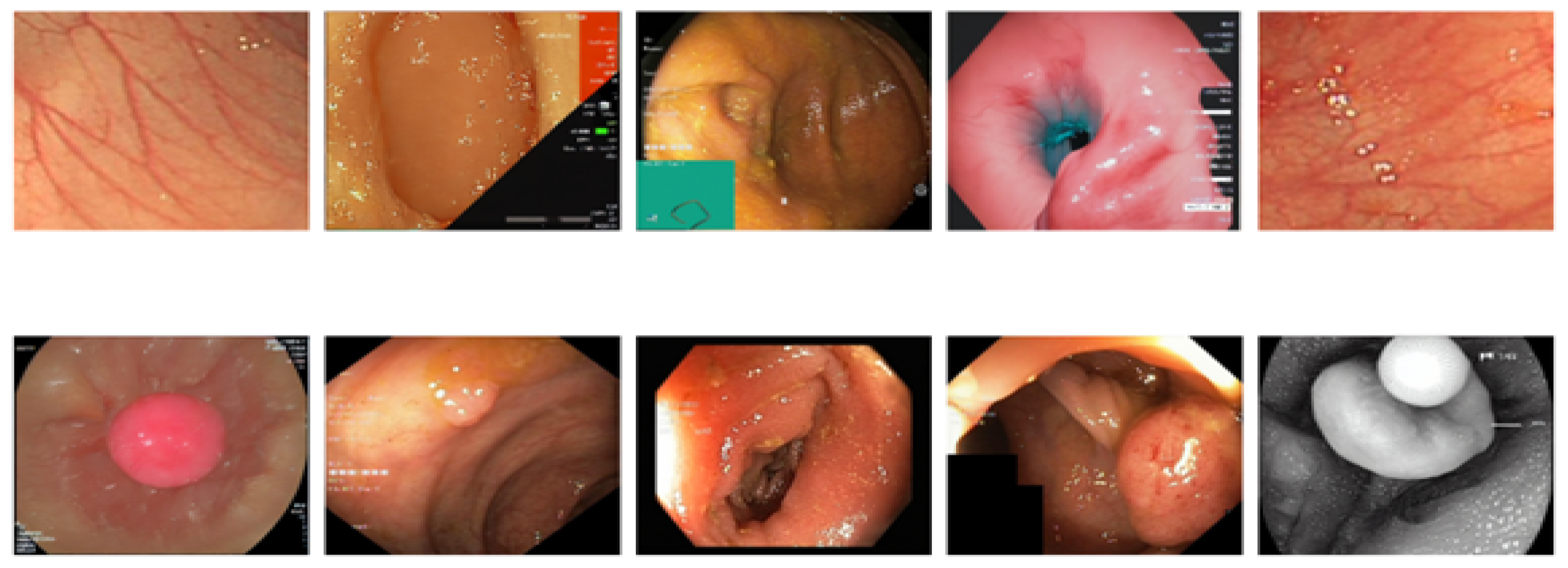 Algorithms 18 00155 g016