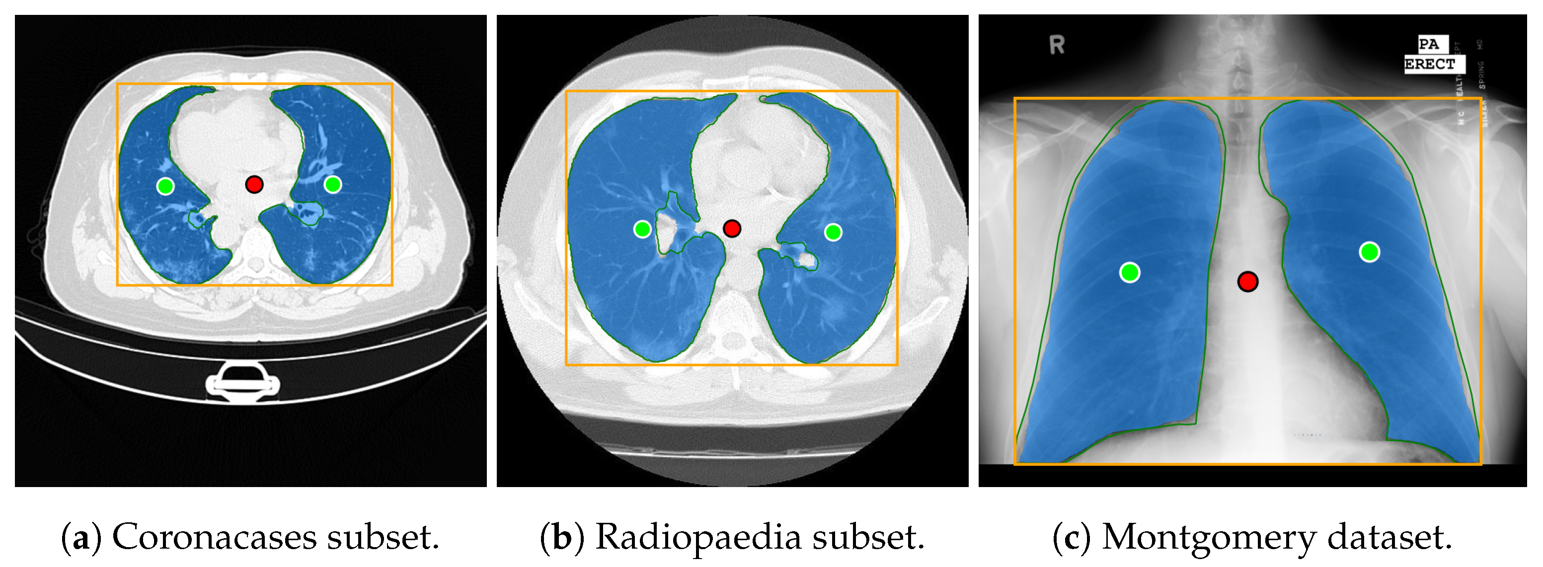 Algorithms 18 00227 g001