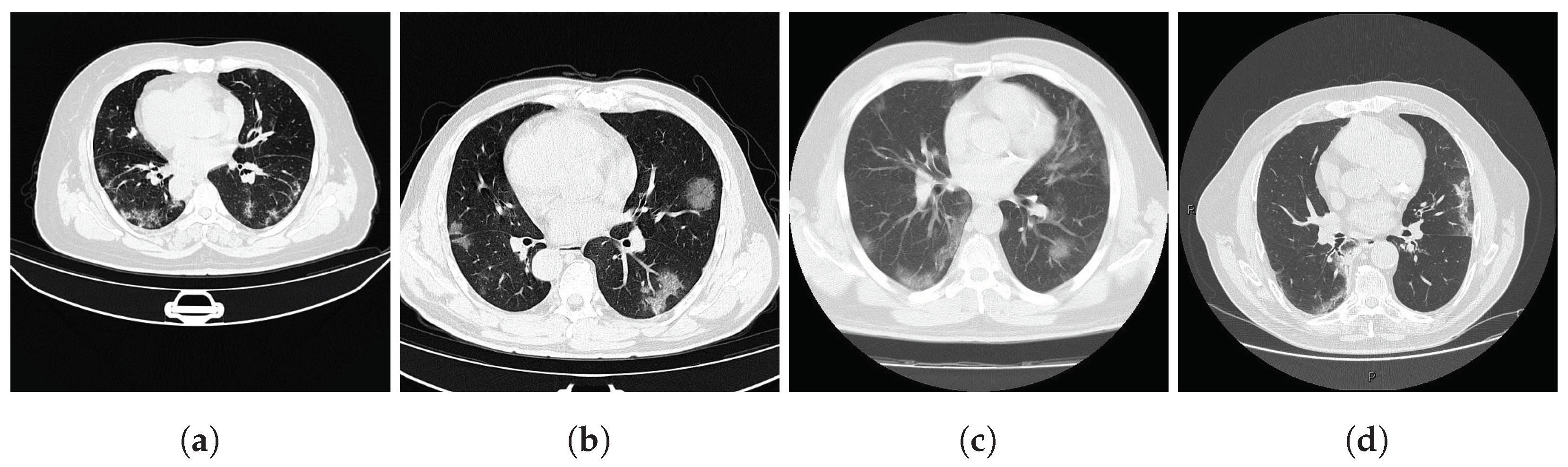 Algorithms 18 00227 g013