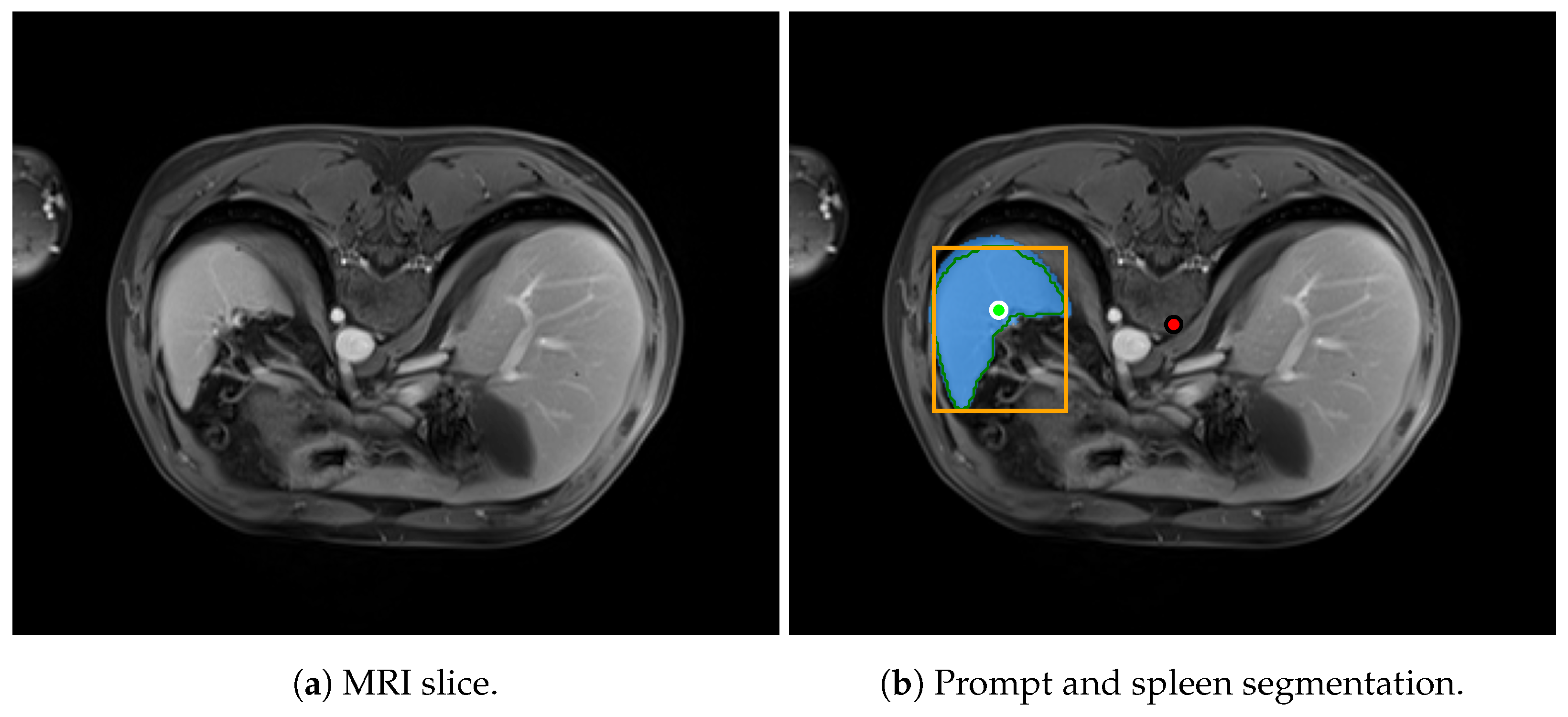 Algorithms 18 00227 g015